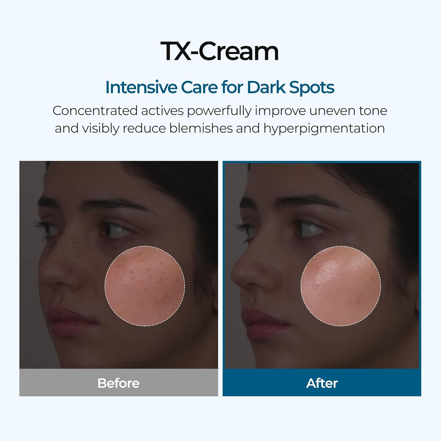 Dr.Melaxin TX Cream