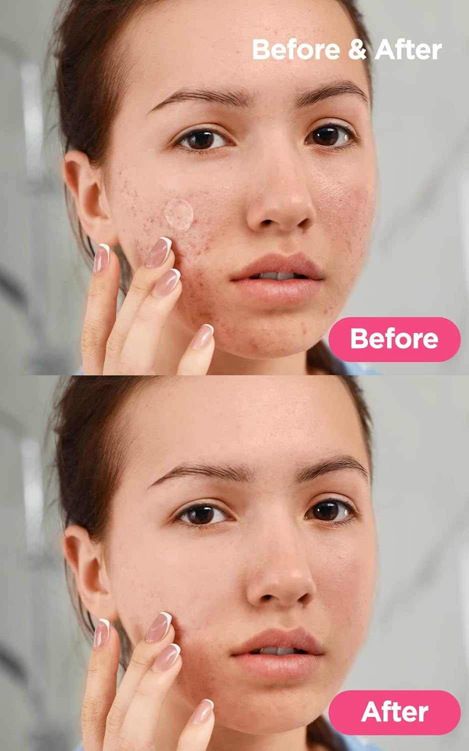 NEOGEN DERMALOGY A-CLEAR SOOTHING SPOT PATCH 24 COUNT (2 PACK) image number 1