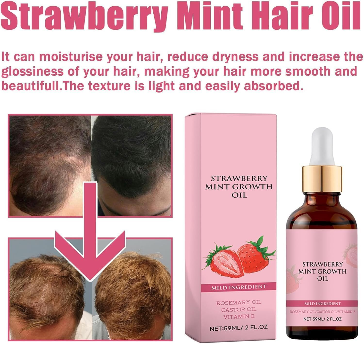 GTWEPZ 2Pcs Strawberry Mint Growth Oil,Strawberry Mint Hair Growth Oil,Organic Hair Growth Serum for Thin Hair Dry Damaged Hair, Beige image number 5