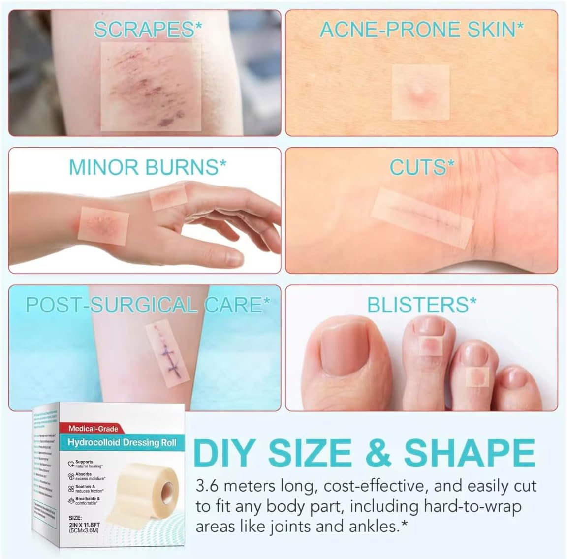 Hydrocolloid Dressing Roll 2In &times; 11.8Ft (5Cm &times; 3.6M) &ndash; Self-Adhesive Waterproof Film &ndash; Medical-Grade, Flexible & Cut-To-Size Dressing Tape for Blisters, Acne, Cuts & Daily Skin Protection &ndash; One Roll by MAYN image number 3