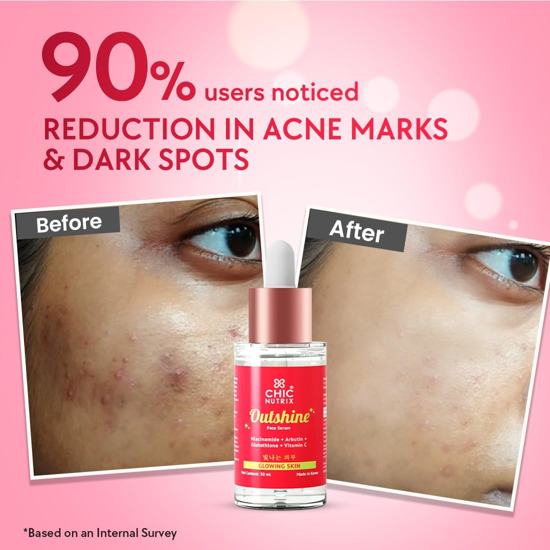 Chicnutrix Outshine &ndash; with Korean 2% Niacinamide + Glutathione + Vitamin C | Helps Brighten Dull Skin, Clears Dark Spots, Blemishes, Acne Marks & Pigmentation | Korean Glass Skin Serum image number 5