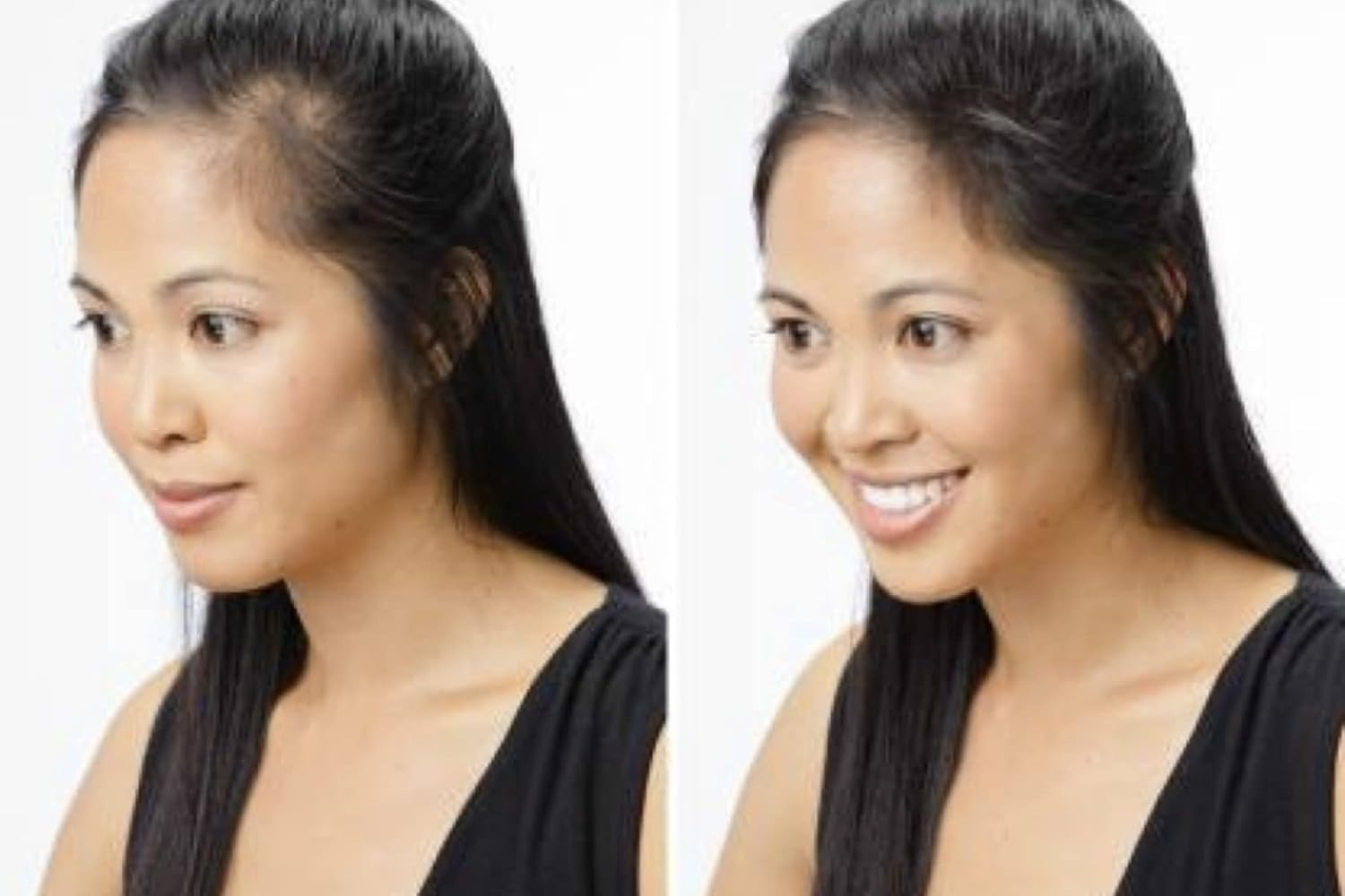 Shills Professional Black Hair Building Fibers Men,Women Fibers for Hair Loss Coverage (Net 25G) image number 2