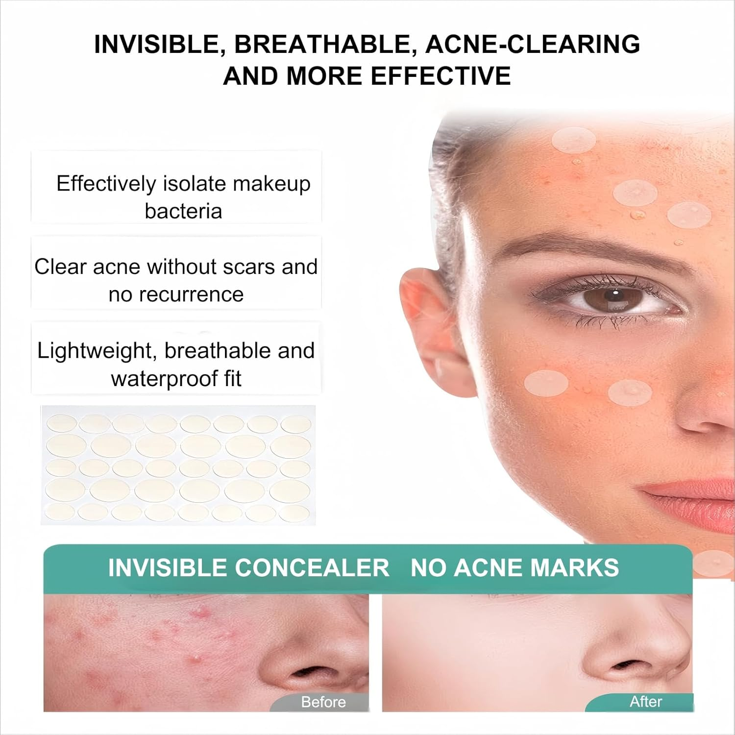 AYOCULTURE Fast-Acting Pimple Patches - Hydrocolloid Acne Patch for Overnight Use - 360Pcs image number 1