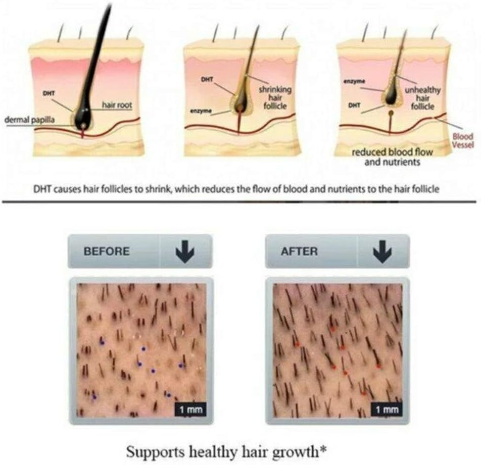 Hair Regrowth Serum-Hair Growth Essence Oil, Hair Growth Treatment, Stops Hair Loss, Thinning,Balding, Promotes Thicker, Fuller and Faster Growing Hair image number 6