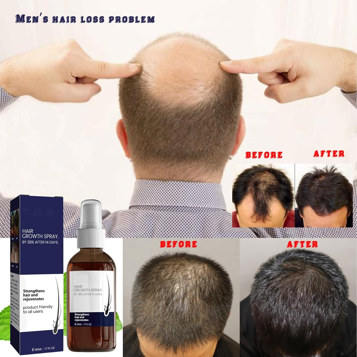 3PCS Hair Growth Spray for Men & Women, 50Ml Polygonum Multiflorum Root Extract and Ginger Root Oil Nourish Hair, Hair Enhance Serum for Dry, Frizzy, Damaged Hair