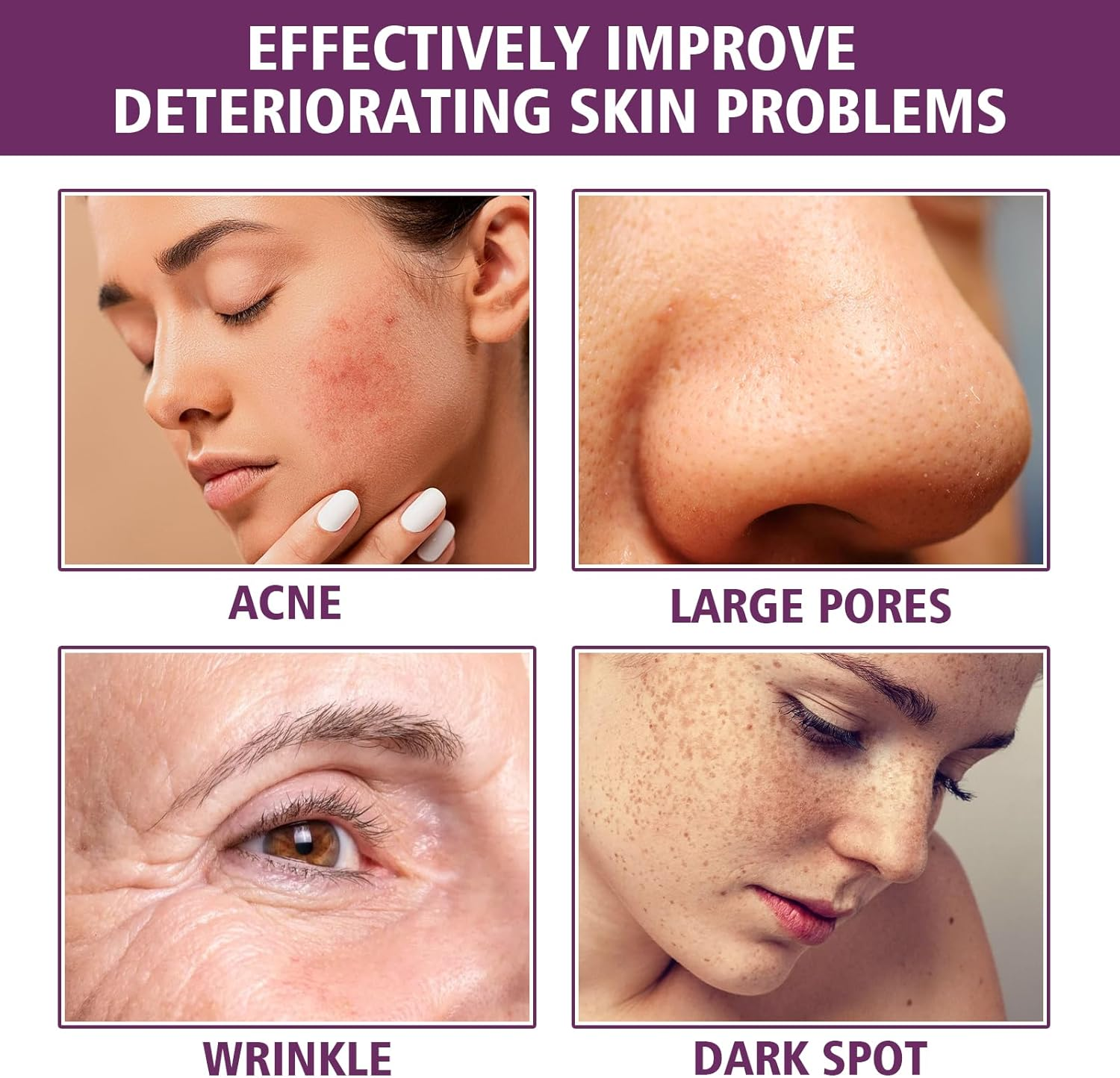 Niacinamide 20% Serum for Face, Brightening, Enhances Elasticity, Moisturizing, Anti-Wrinkle, Even Skin Tone, Smoothes Fine Lines, Reduces Pigmentation, Pores Care for Sensitive Skin (6Pcs) - 12Pcs image number 3