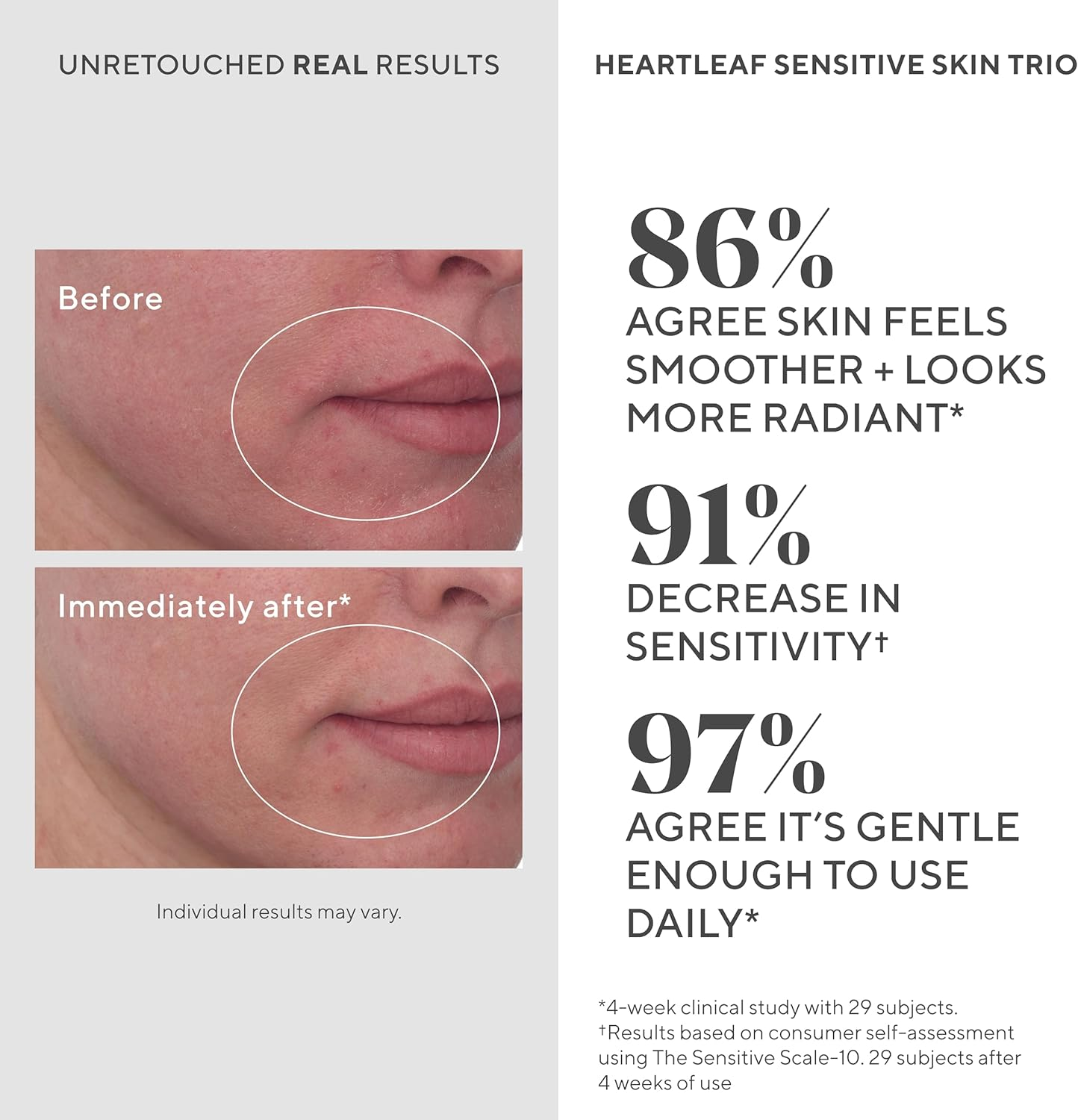 Murad Heartleaf Soothing Cleanser &ndash; Gentle Face Wash with Fermented Heartleaf, Beta-Glucan, Ceramides, and Microalgae to Reduce Redness & Calm Sensitive and Eczema-Prone Skin &ndash; 50 Ml image number 4