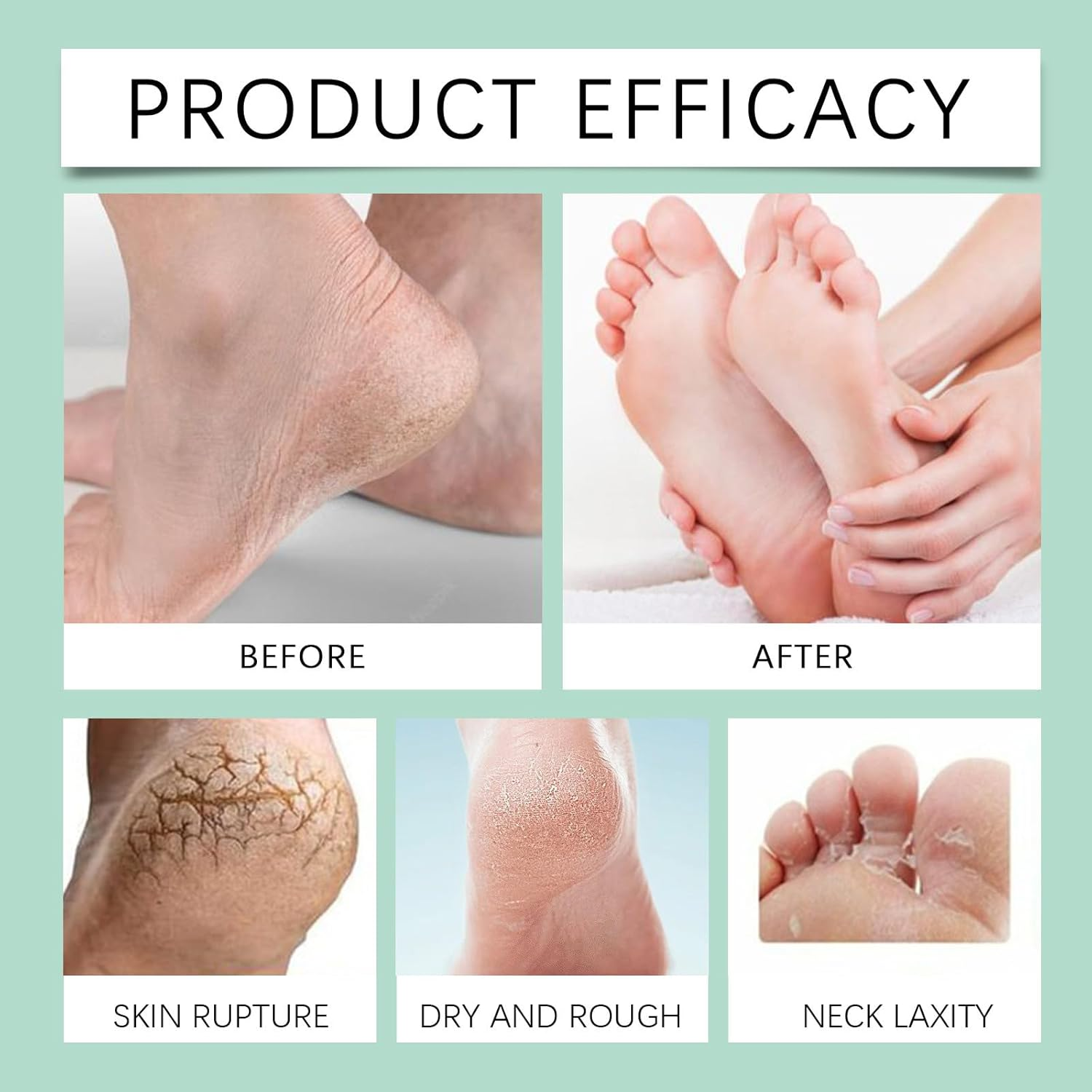 Peeling Spray with Aloe Vera, Exfoliating Foot Peel, Callus Remover for Feet and Heel Care, Hydrating Care for Cracked Heels, Feet Scrubber Dead Skin, Smooth Soft Skin (4Pcs) image number 3