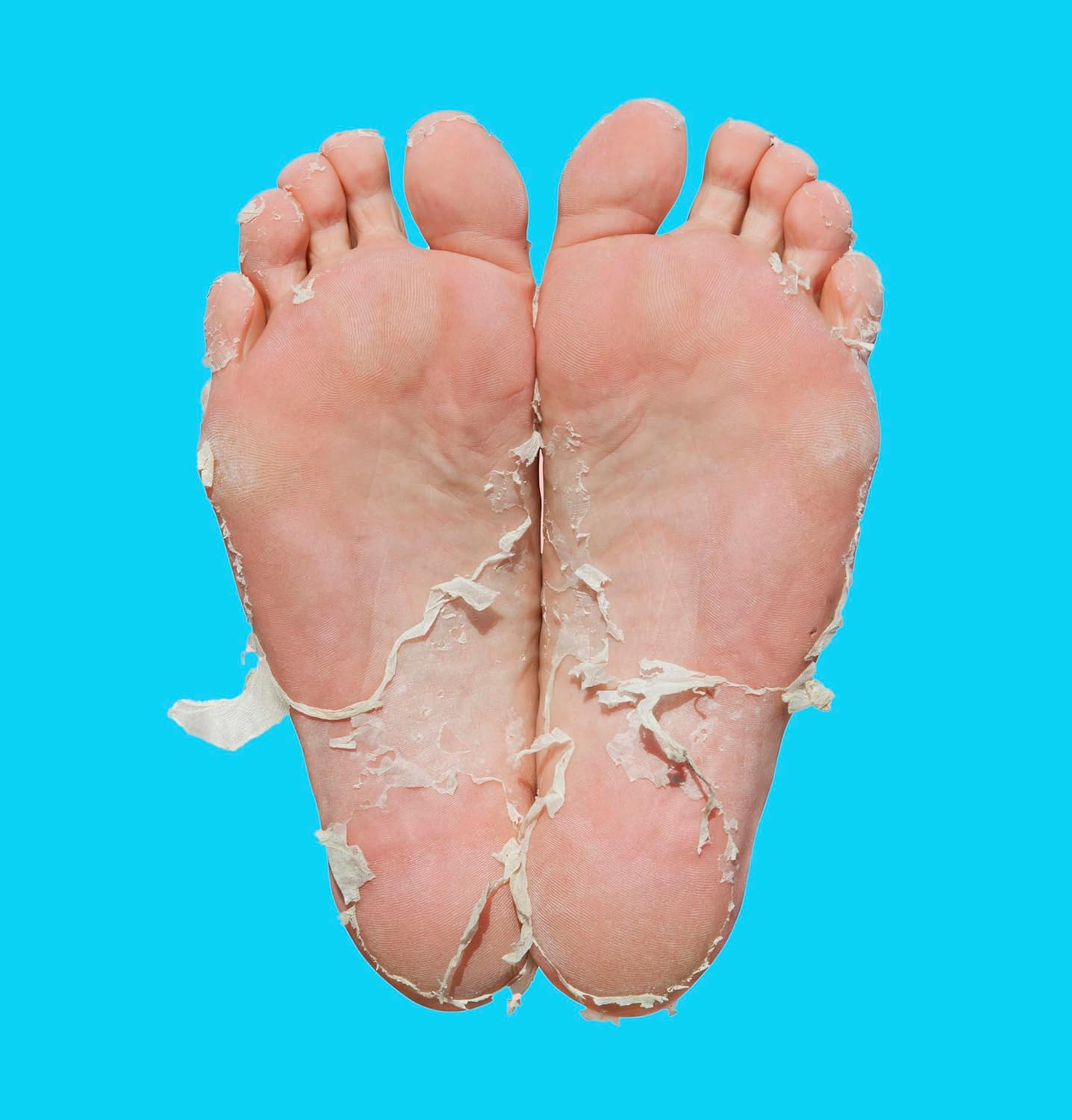 Skin Republic Pedi Foot Peel Max | 15% Stronger Acids for Removing Severely Dry Skin & Cracked Heels | Effectively Eliminates Foot Odour (Pack of 1) image number 2