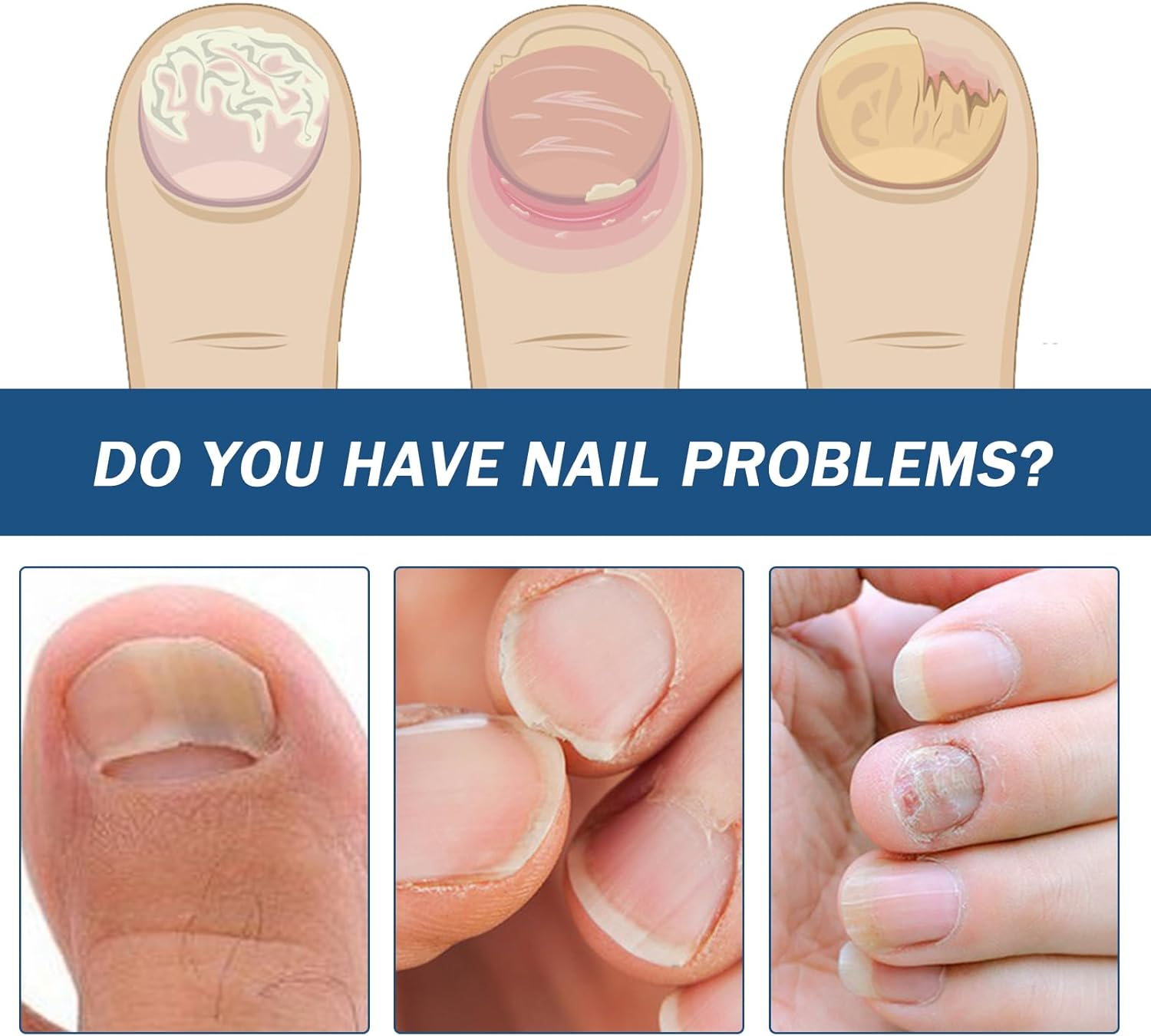 64 Pieces Nail Plasters Multipurpose Nail Care Pads for the Appearance of Damaged or Discolored Nails image number 2