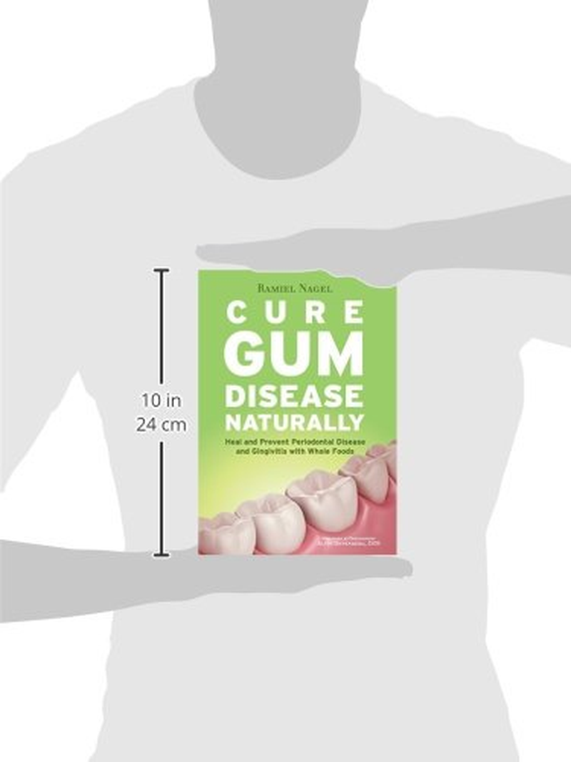 Cure Gum Disease Naturally: Heal Gingivitis and Periodontal Disease with Whole Foods