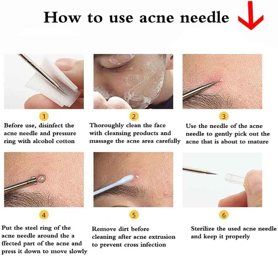 9-Piece Blackhead Remover Tool Kit, Professional Pimple Extractor Comedone with Leather Case - Stainless Steel Blemish Acne Removal Tools for Face, Safe on Sensitive & Oily Skin image number 5