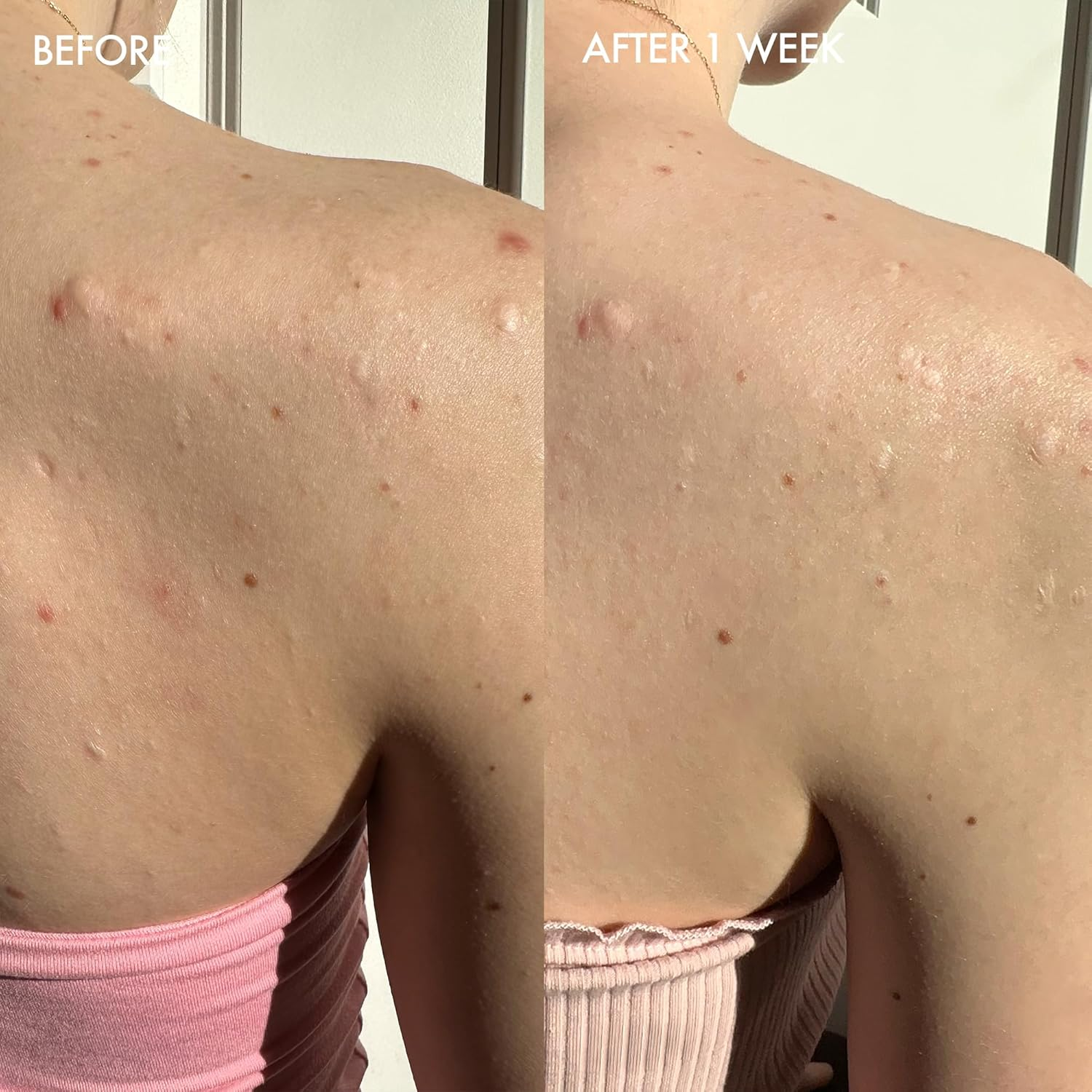 Dermisa Sulfur Facial Bar, 3 Ounce