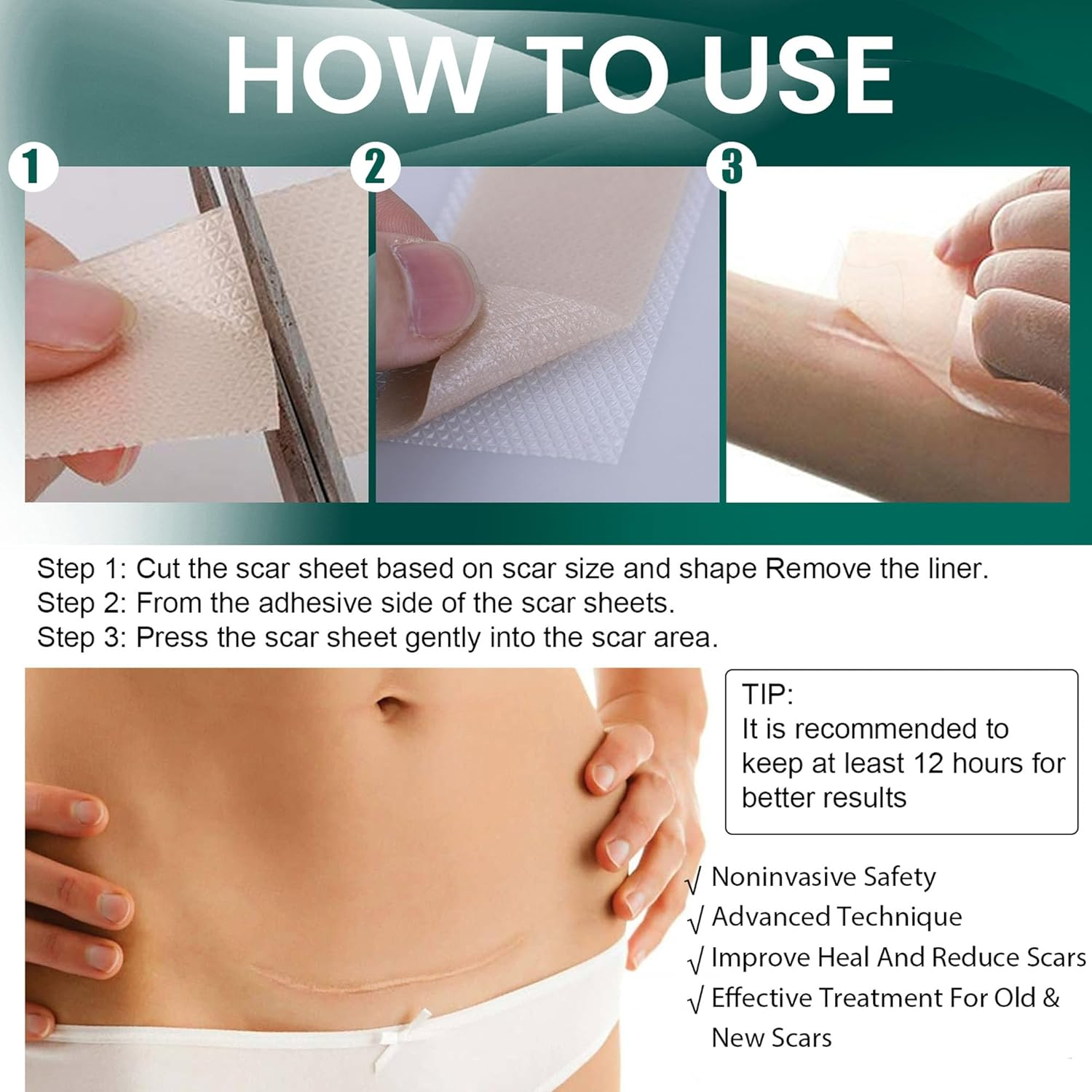 Silicone Scar Tape, Soft Silicone Scar Tape Painless Silicone Tape Roll for Surgical Keloid and Acne Scars (4 * 150Cm) image number 4