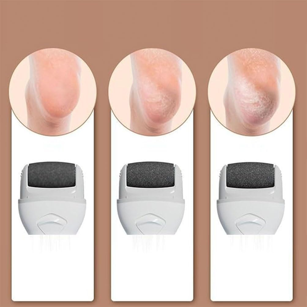 HPAMR Electric Foot Grinder Electric Foot Callus Remover Portable Electronic Foot File Pedicure Foot Tool Pedi Feet Care with 3 Grinding Heads for Dead, Cracked Dry Skin image number 2