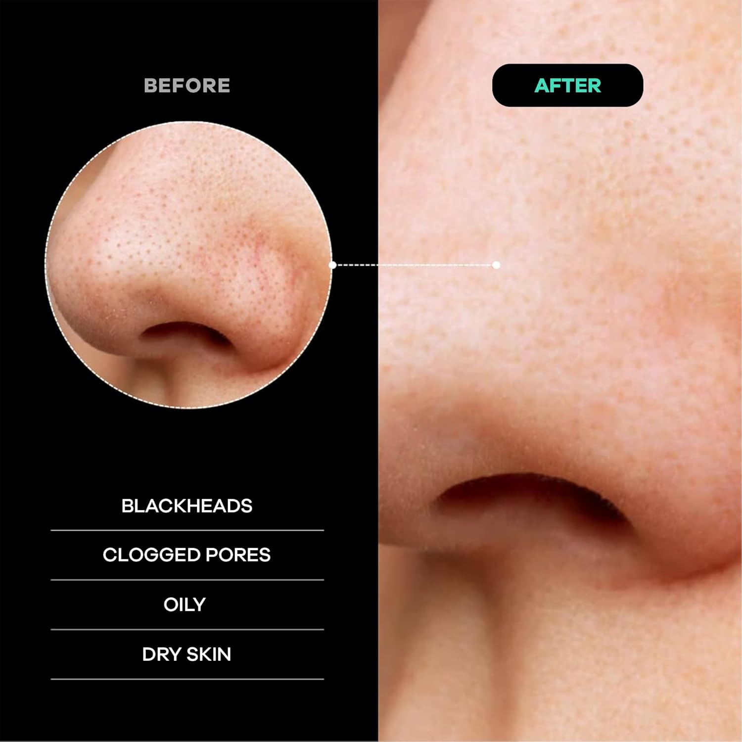 Dermasuri Exfoliating Face Scrub Mitt, Daily Dead Skin Remover for Smooth Skin, Black image number 5