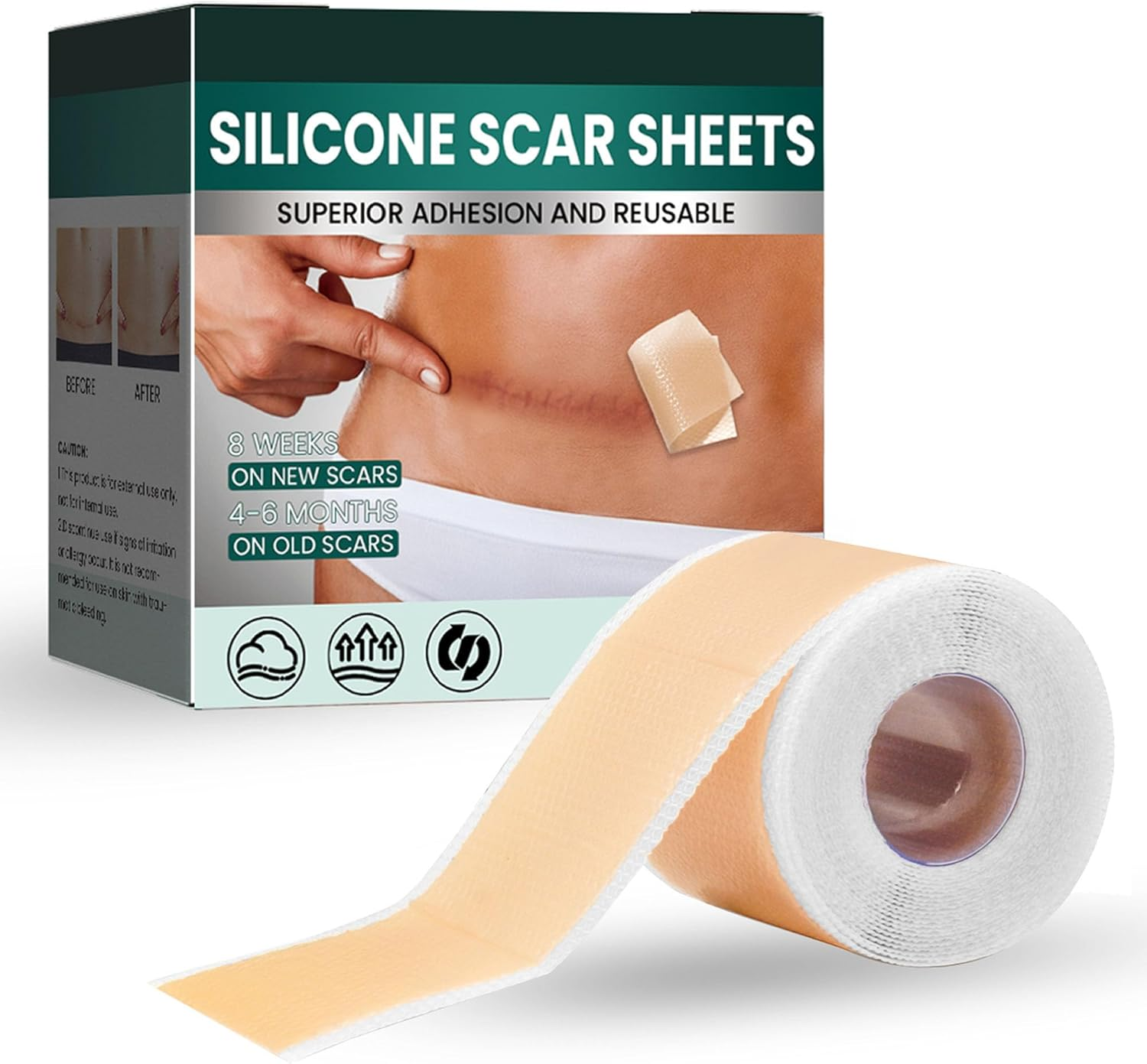 Silicone Scar Tape, Soft Silicone Scar Tape Painless Silicone Tape Roll for Surgical Keloid and Acne Scars (4 * 150Cm) image number 5