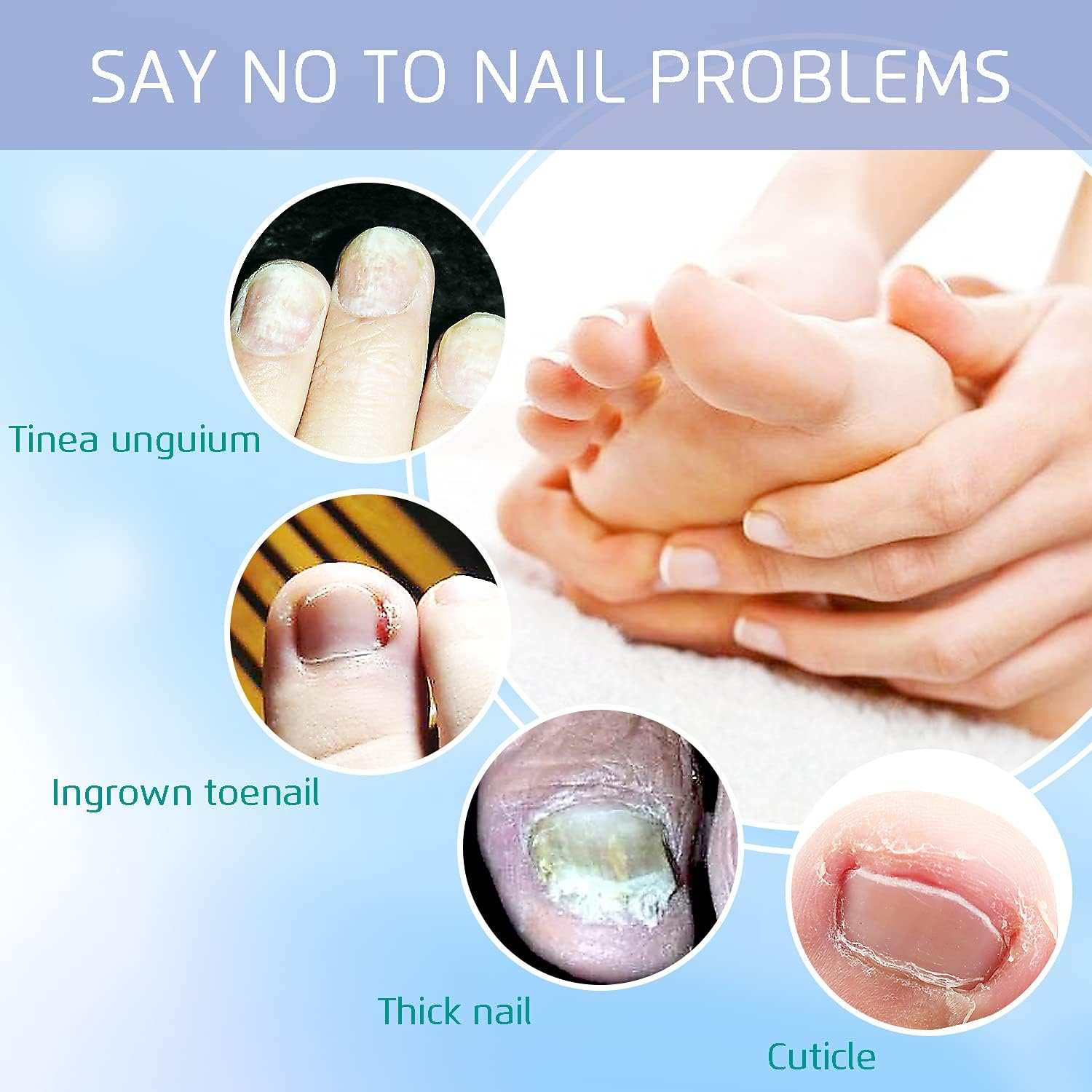 3PCS Ingrown Toenail Remover, Toe Nail Cutter, Nail Clipper, Lifter and File, Pedicure Tools, Nail Treatment Foot Set, Surgery Grade Stainless Steel, for Onychomycosis Paronychia image number 3