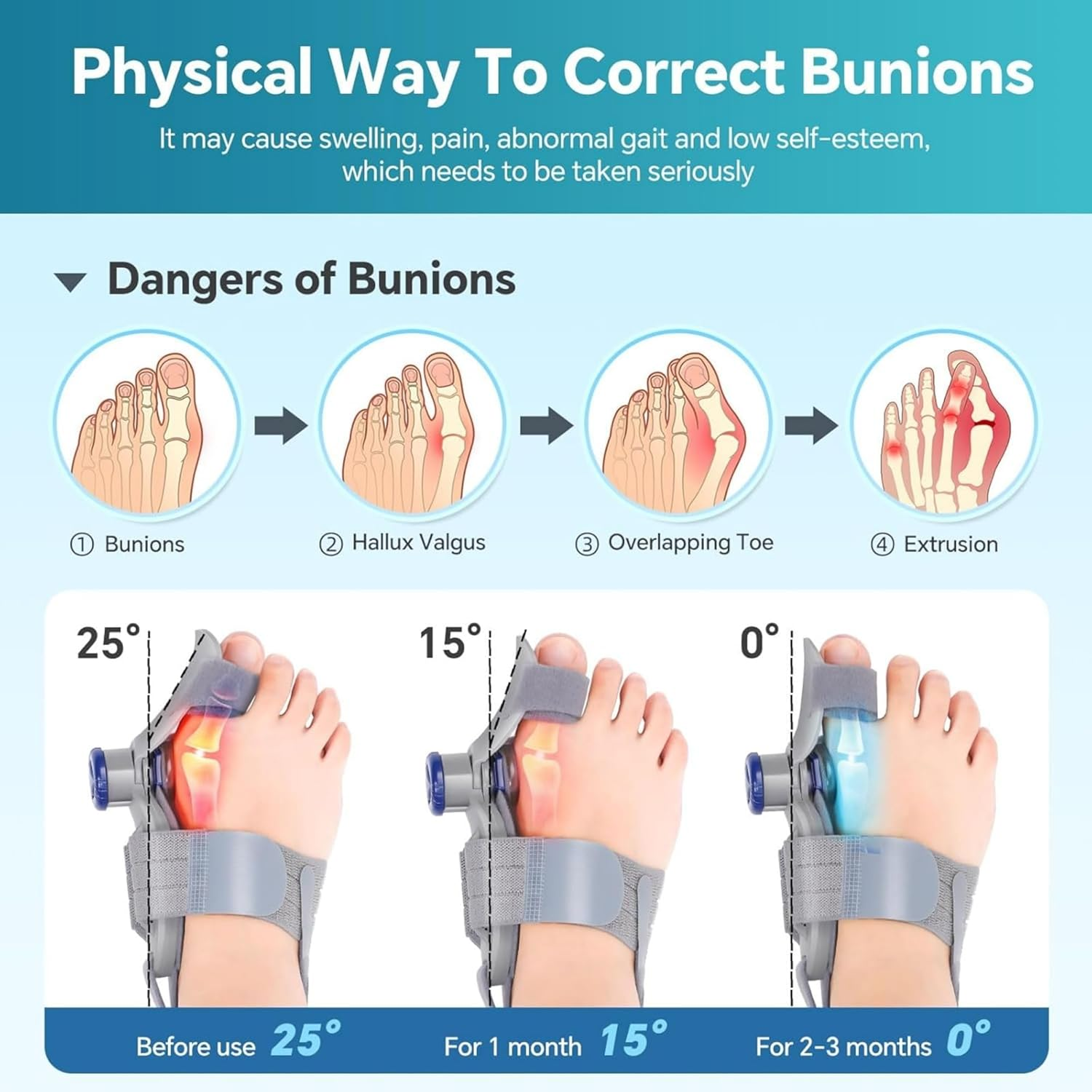 Bunion Corrector for Women & Men, Adjustable Bunion Corrector with Soft Gel Pad, Anti-Slip Toe Separators for Bunion Relief, Toe Straightener, Suitable for Left and Right Feet (Gray)