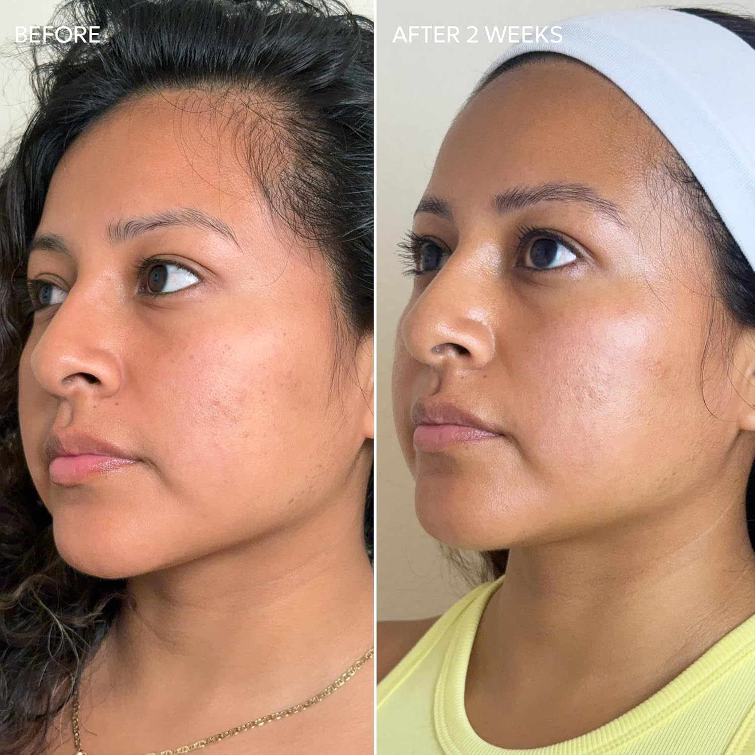 Skin Fade Cream by Dermisa for Unisex - 1.78 Oz Cream image number 6