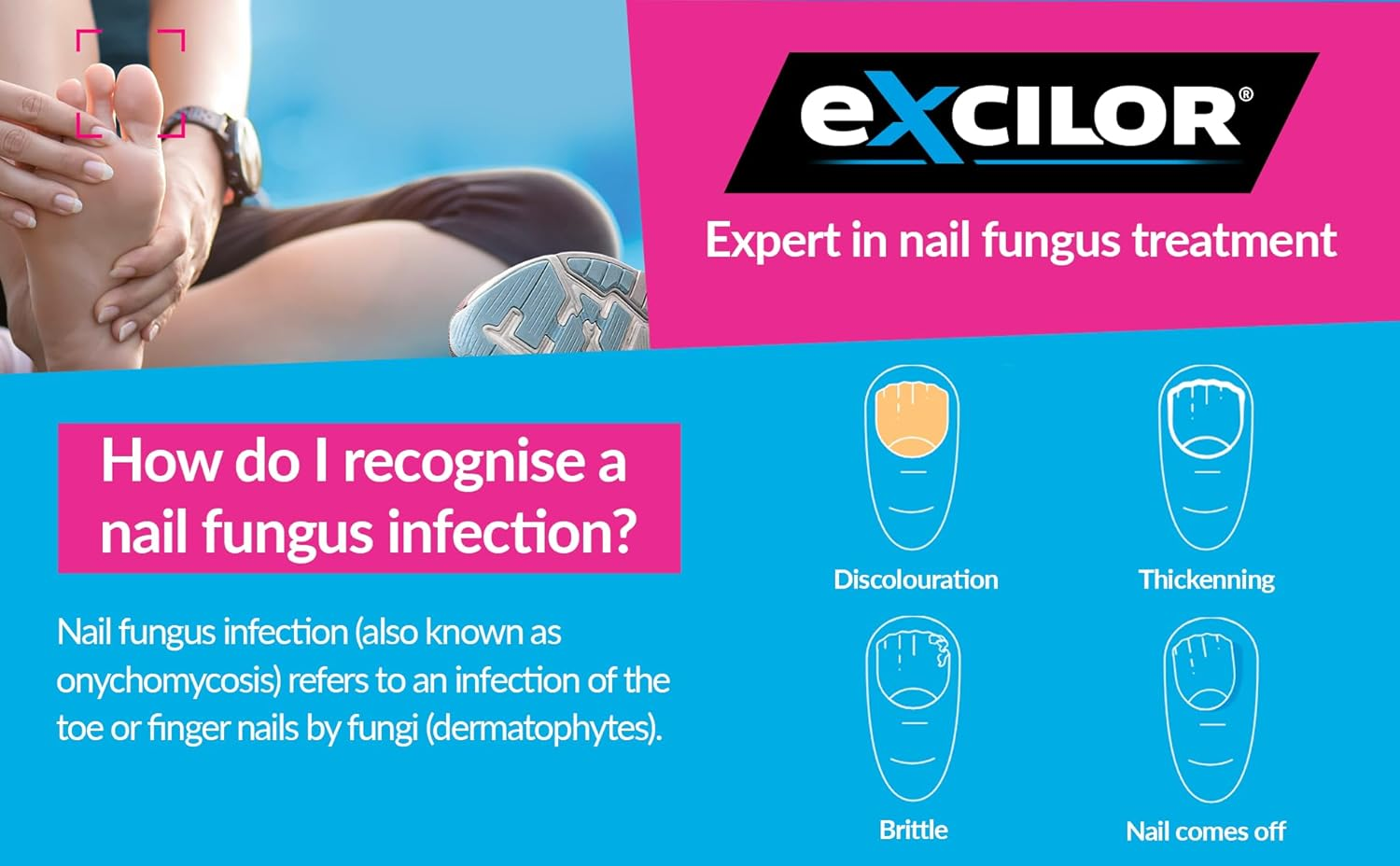 EXCILOR - Nail Fungus Treatment ULTRA - Forte - Extra Strong Formula against Persistent Nail Fungus - Clinically Proven - 1 Application per Day - 30Ml image number 6
