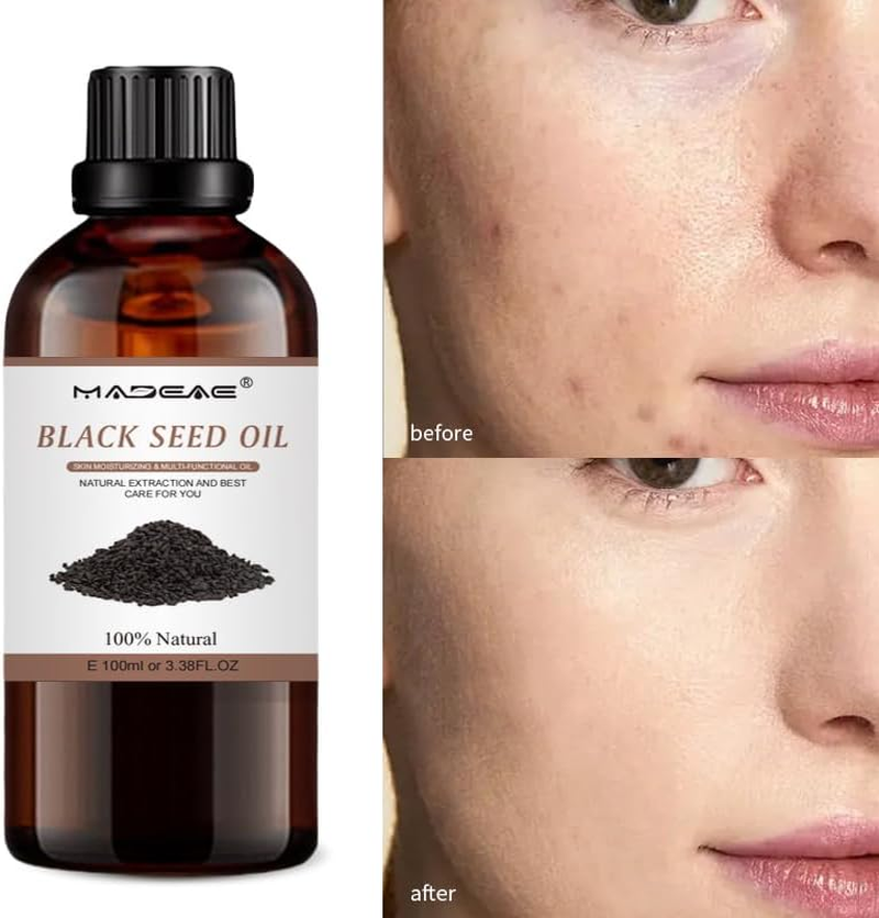 Organic Black Seed Oil for Face and Skin, Cold Pressed, Pure, USDA Certified, 100Ml image number 1