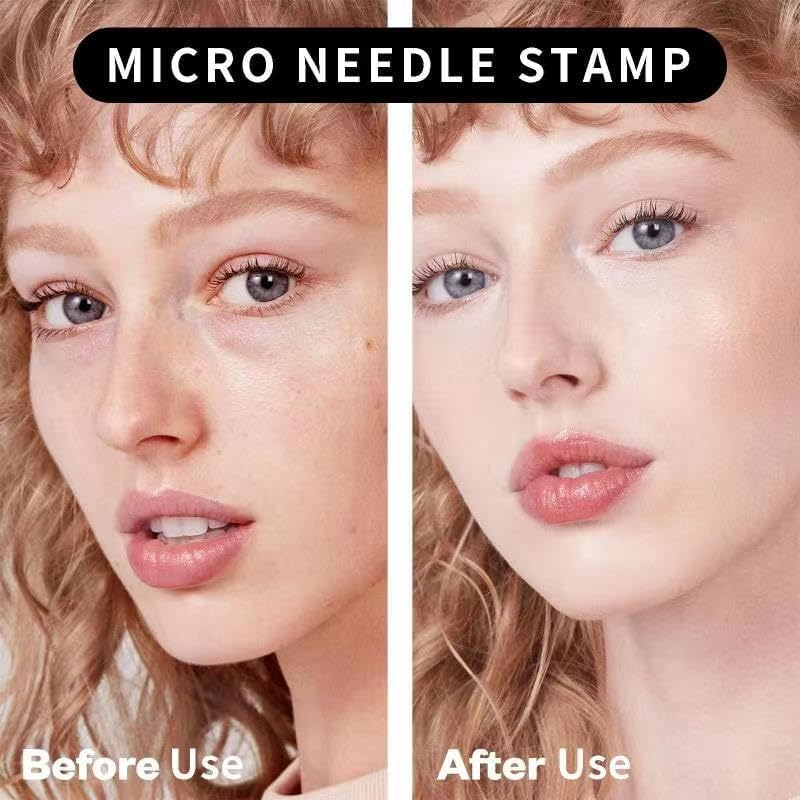 Zephyrcraft Derma Stamp Hair, Beard Growth Micro Elegant Pen for Body and Beard Growth, Lightweight, Micro Needle Stamp 0-3 Mm, 140 Grade a Titanium Needles, Dermastamp Adjustable image number 5