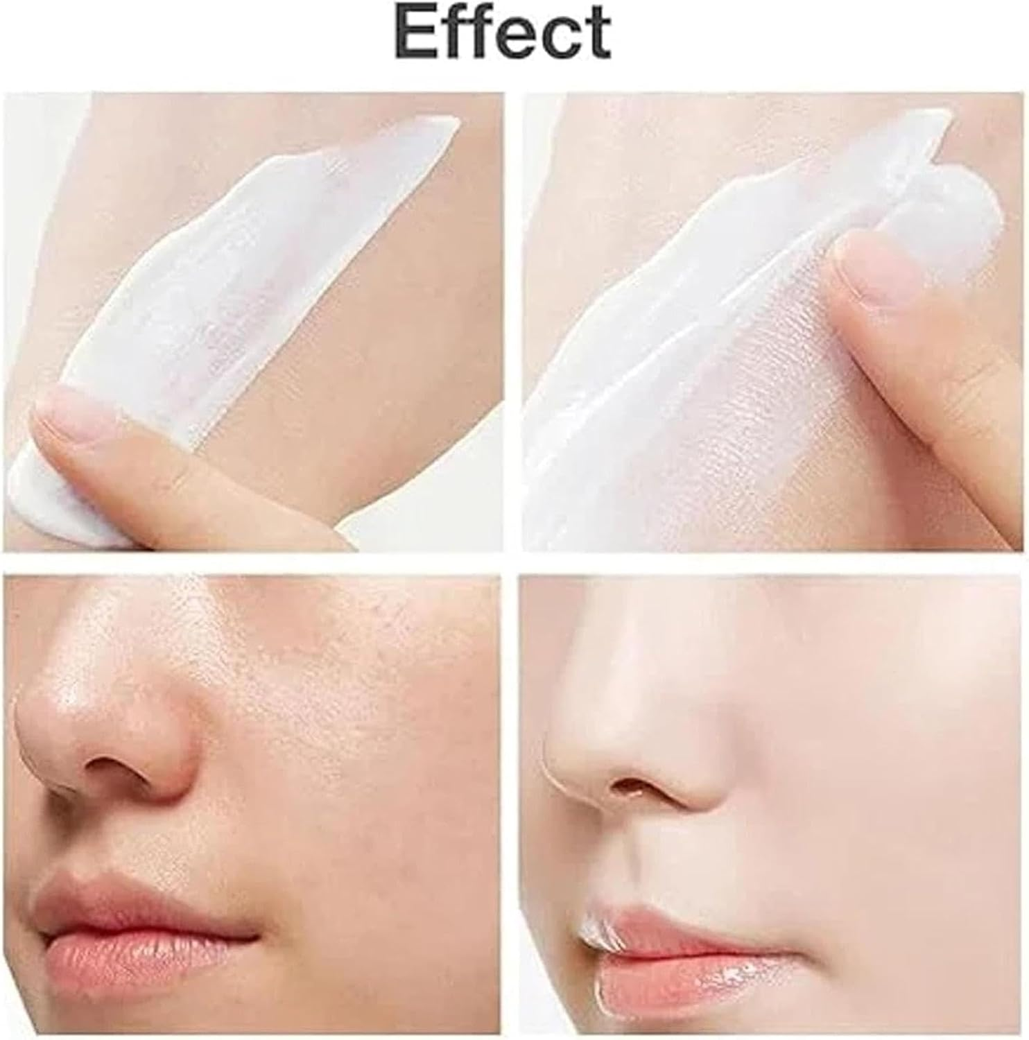 2Pcs Ac-Ne Cream - 20G Pair Ac-Ne Cream Japa, Pair Japanese Ac-Ne Cream, Long-Lasting Moisturizing, No Dryness, Ac-Ne Treat-Ment Removal Cream for Pimples Prone Skin, Mild and Harmless to Skin image number 1