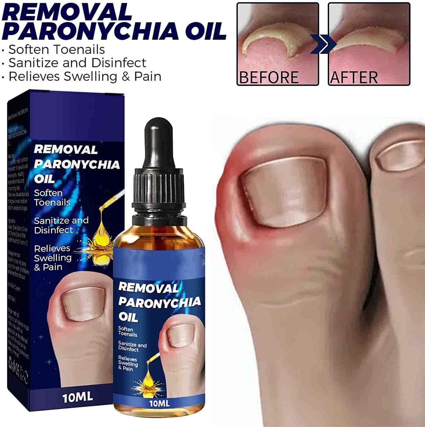 German Toenailcare Removal Paronychia Oil, German Toenailplus anti Paronychia Relief Oil, 2023 New German Toenail Care Removal Paronychia Oil (2PCS) image number 1