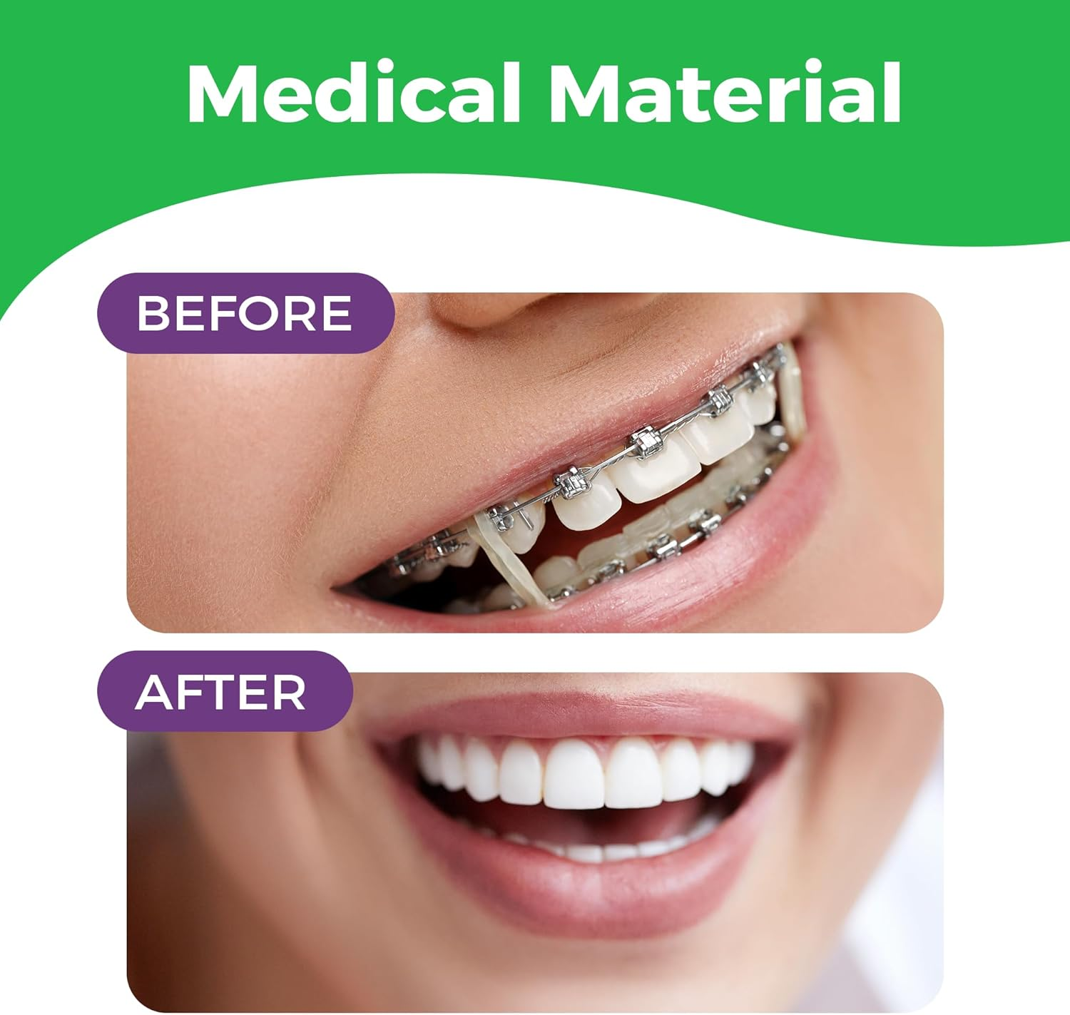 Orthodontic Elastic Rubber Bands 1/8 Inch - 100 Pack, Neon, Heavy Force 4.5 Oz - Dental Gap Fixer, Dreadlock Bands, 1 Elastic Placer Included image number 3