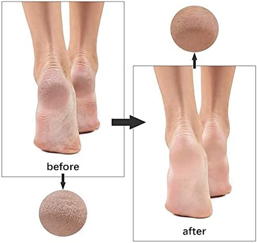 DMX INTL Stainless Steel Foot File Double Sided Pedicure Rasp Dead Hard Dry Cracked Skin Callus Remover Scraper Scrubber Foot Care Tool (2) image number 1