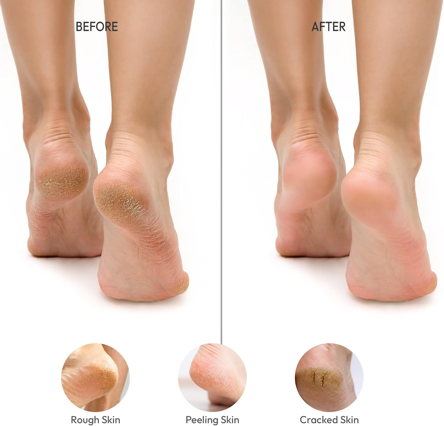 RED by Kiss Stainless Steel Ped Egg Foot File 2 In-1 Callus Remover for Dry and Wet Feet, Smooth Rough Skin, Include 2 Grit (Soft & Hard), Washable Foot Scrubber for Cracked Heels image number 2