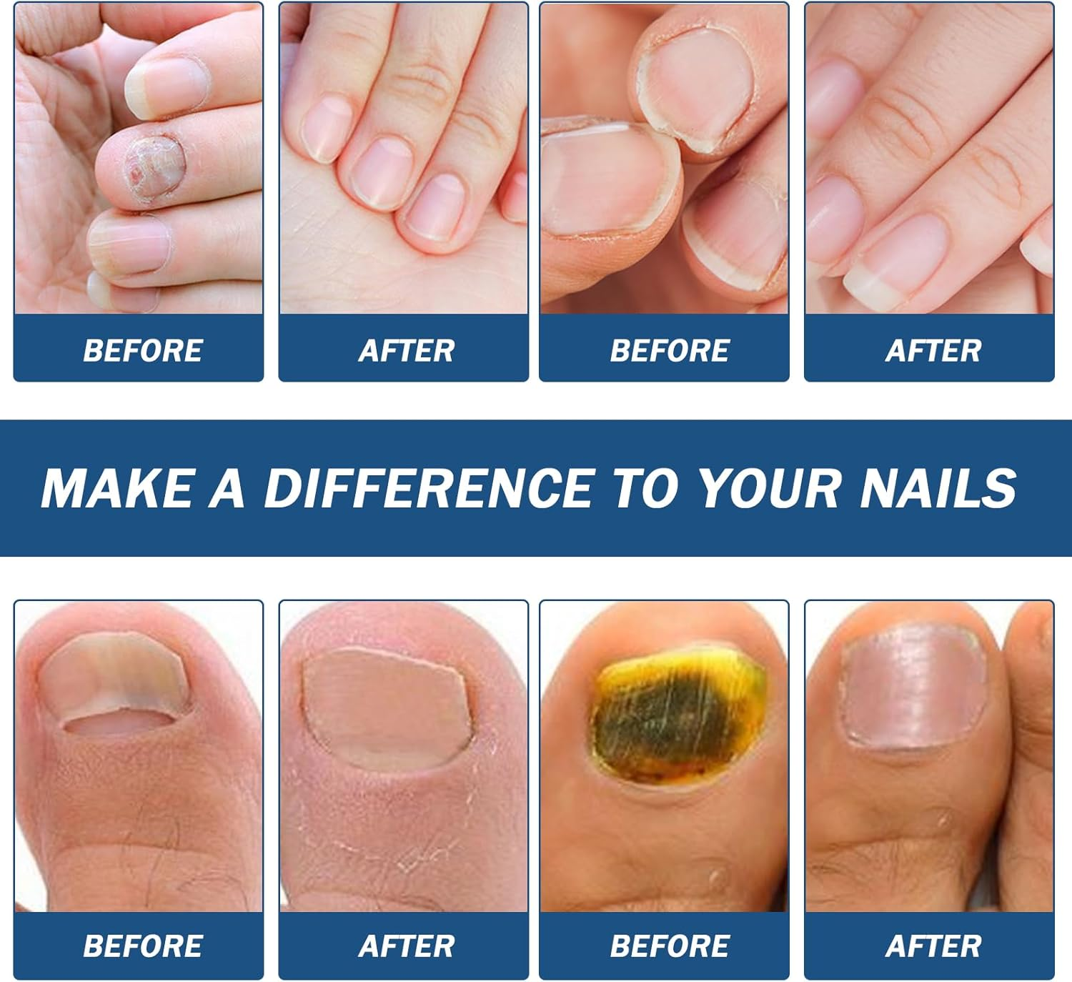 64 Pieces Nail Plasters Multipurpose Nail Care Pads for the Appearance of Damaged or Discolored Nails