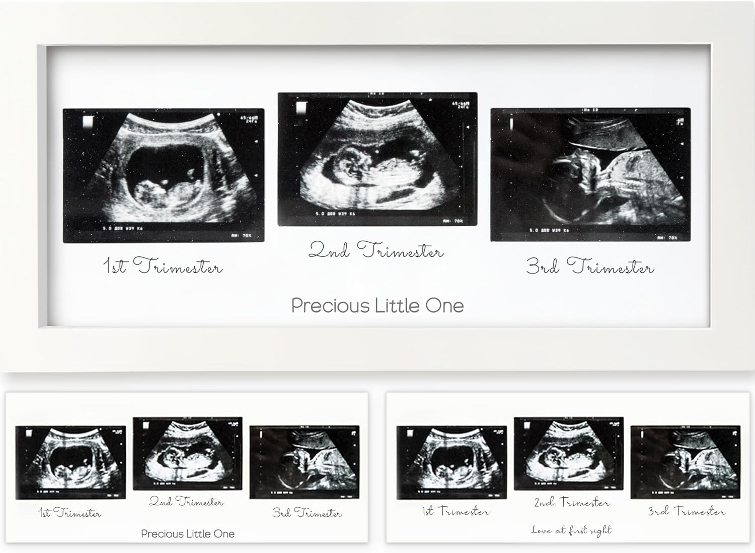 Sonogram Picture Frame - Trio Ultrasound Picture Frames for Mom to Be Gift - Baby Ultrasound Frame for Pregnancy Announcements - Baby Nursery Decor, Pregnant Mom Gifts (Alpine White)