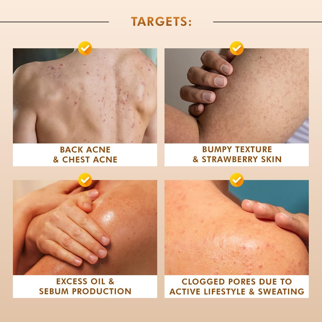 Mcaffeine 7% Exfoliating Body Wash with 1% Salicylic 2% Lactic Acid | Reduces Body Acne, Strawberry Skin, Ingrown Hair & Smoothes | Sweet Caramel Shower Gel for Women & Men- All Skin Types (300Ml) image number 4