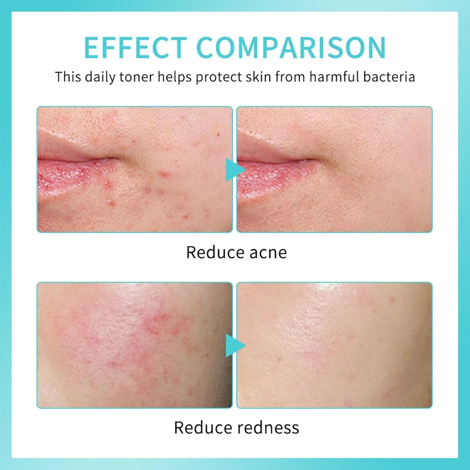 Hypochlorous Acid Spray for Body & Face, HOCL Daily Rescue Facial Spray, Toner Soothing and Purify, Facial Mist, Support against Irritation, Calm Redness image number 6