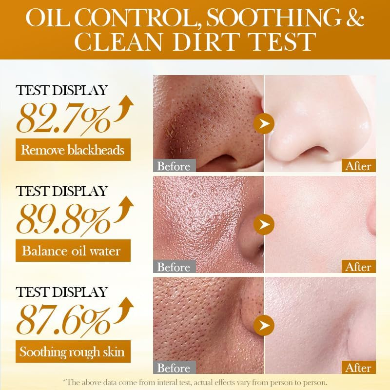 Oil Control Soothing Turmeric Mud Mask Stick, 40G, Renews Radiance image number 6