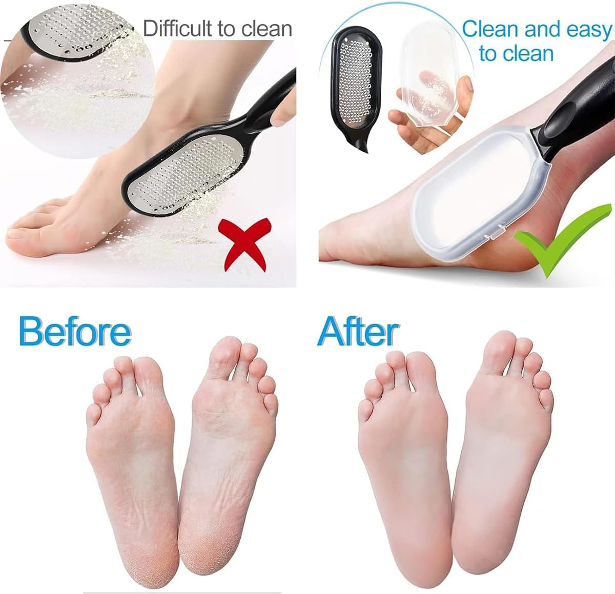 Premium Stainless Steel Pedicure Tool - Ergonomic Foot File for Hard Skin Removal, Durable Heel Scraper for Cracked Heels, Professional Foot Care, Black & White