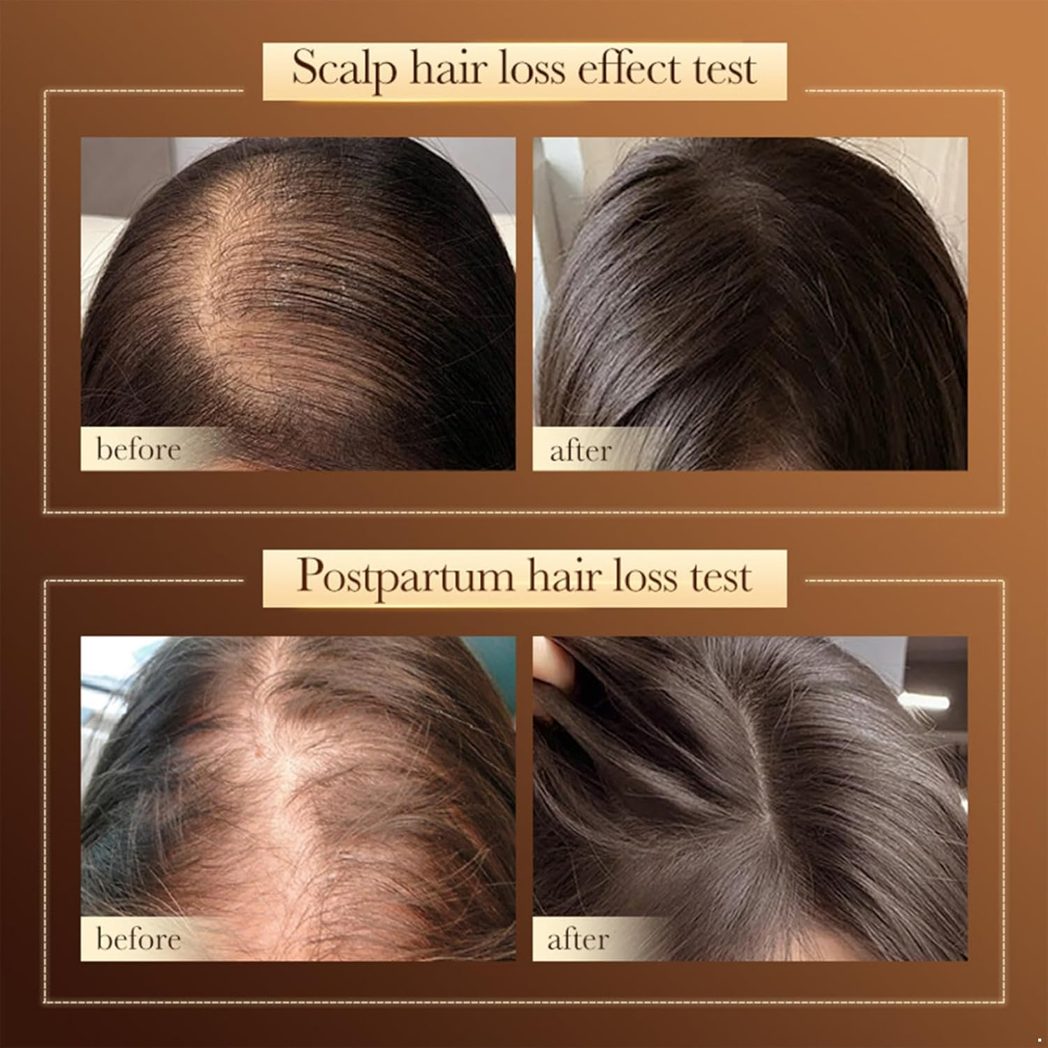 Linjinx Balancing Shampoo for Oil Control and Fresh Feel - Daily Clarifying Care for All Hair Types Coffee One Size