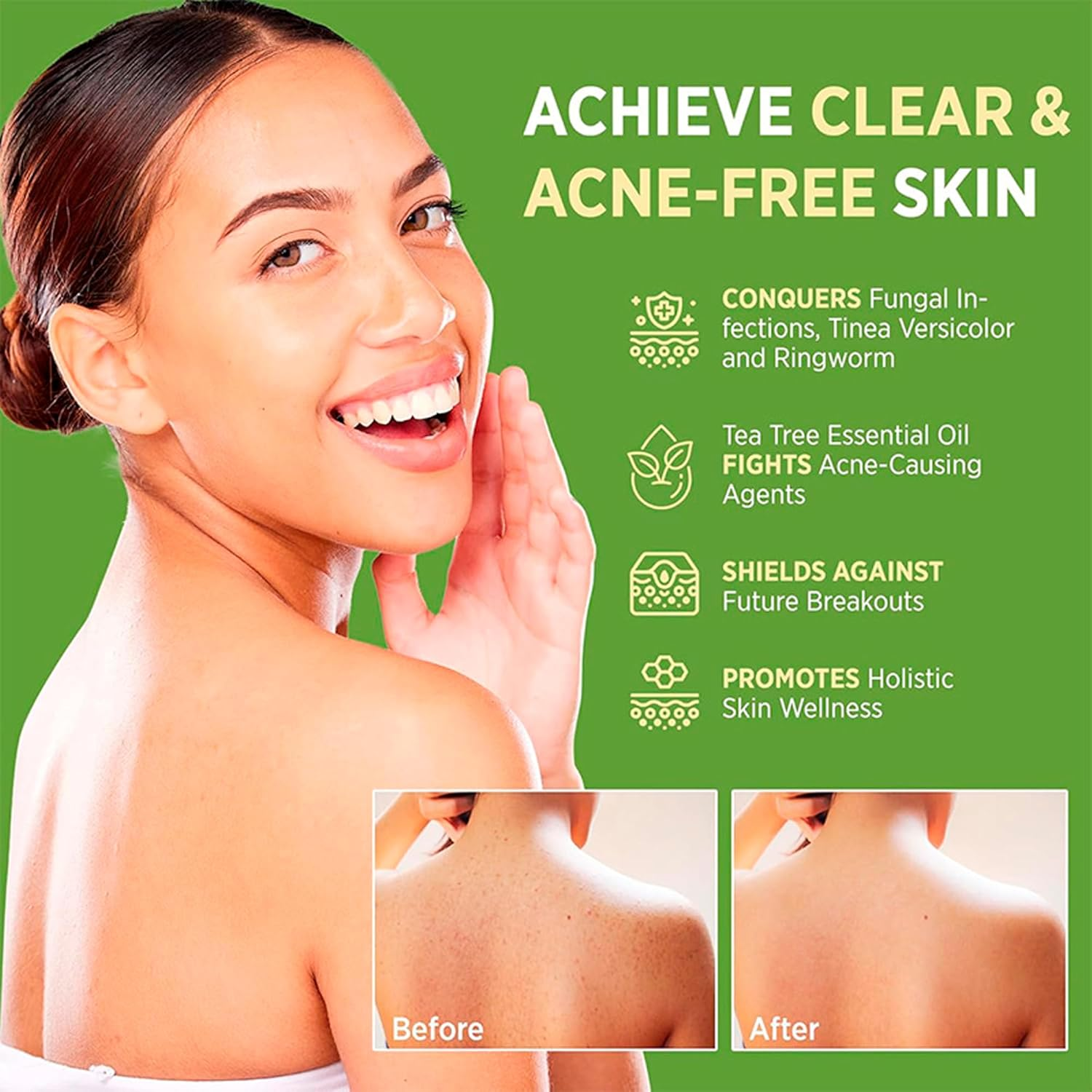 FLYTIN Loravey Relief Soap Bar, Tea Tree Oil Antifungal Soap, Natural Foot & Body Soaps for Healthy Skin, Plant-Based Formula, Refreshing Cleanse (2Pcs)