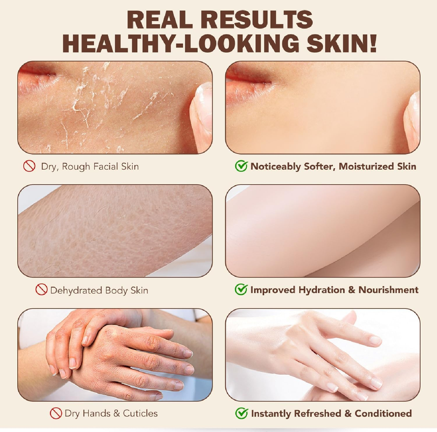 Grass-Fed Beef Tallow & Raw Honey Balm - Whipped Face & Body Moisturizer for Dry Skin - Natural Nourishing Cream with Beeswax for Men & Women - 100G