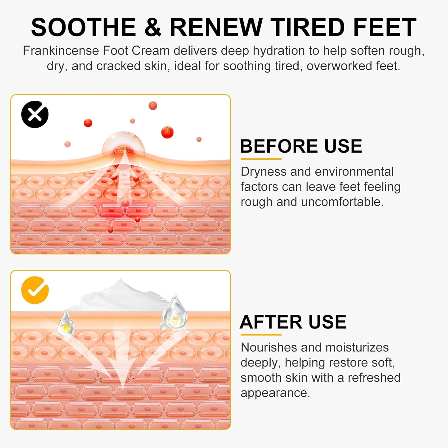 Frankincense Oil Foot Cream 5.29 Fl Oz - Frankincense Balm Support Soreness and Stiffness in Tired Feet & Body - Foot Sole, Achilles, Ankle, Hydration & Repair for Dry Cracked Heels, Feet & Skin