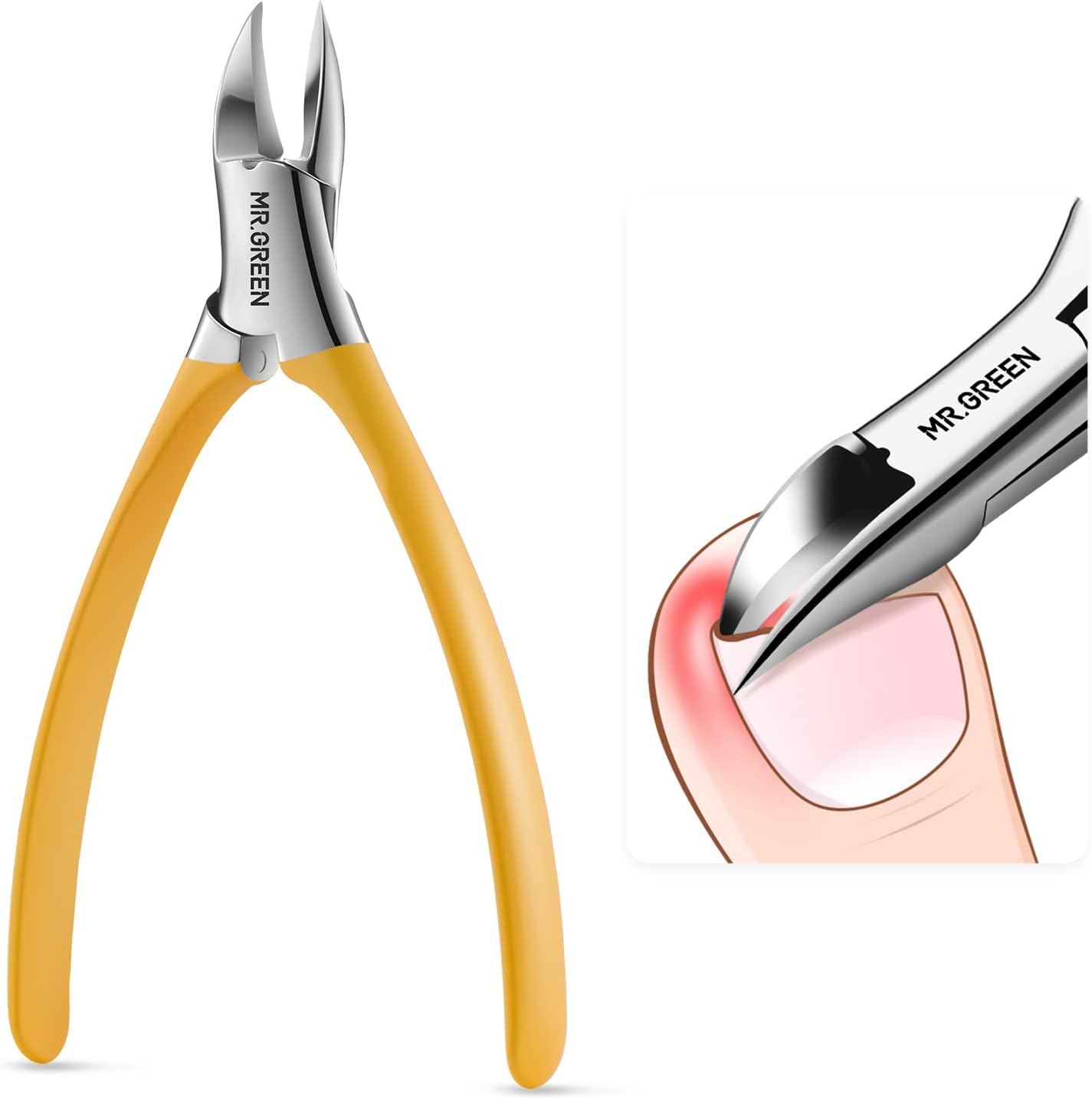 MR.GREEN Toenail Clippers Stainless Steel Ingrown Nail Cutter Thick and Hard Nails Pedicure Manicure Tools (Orange+Nail Remover)