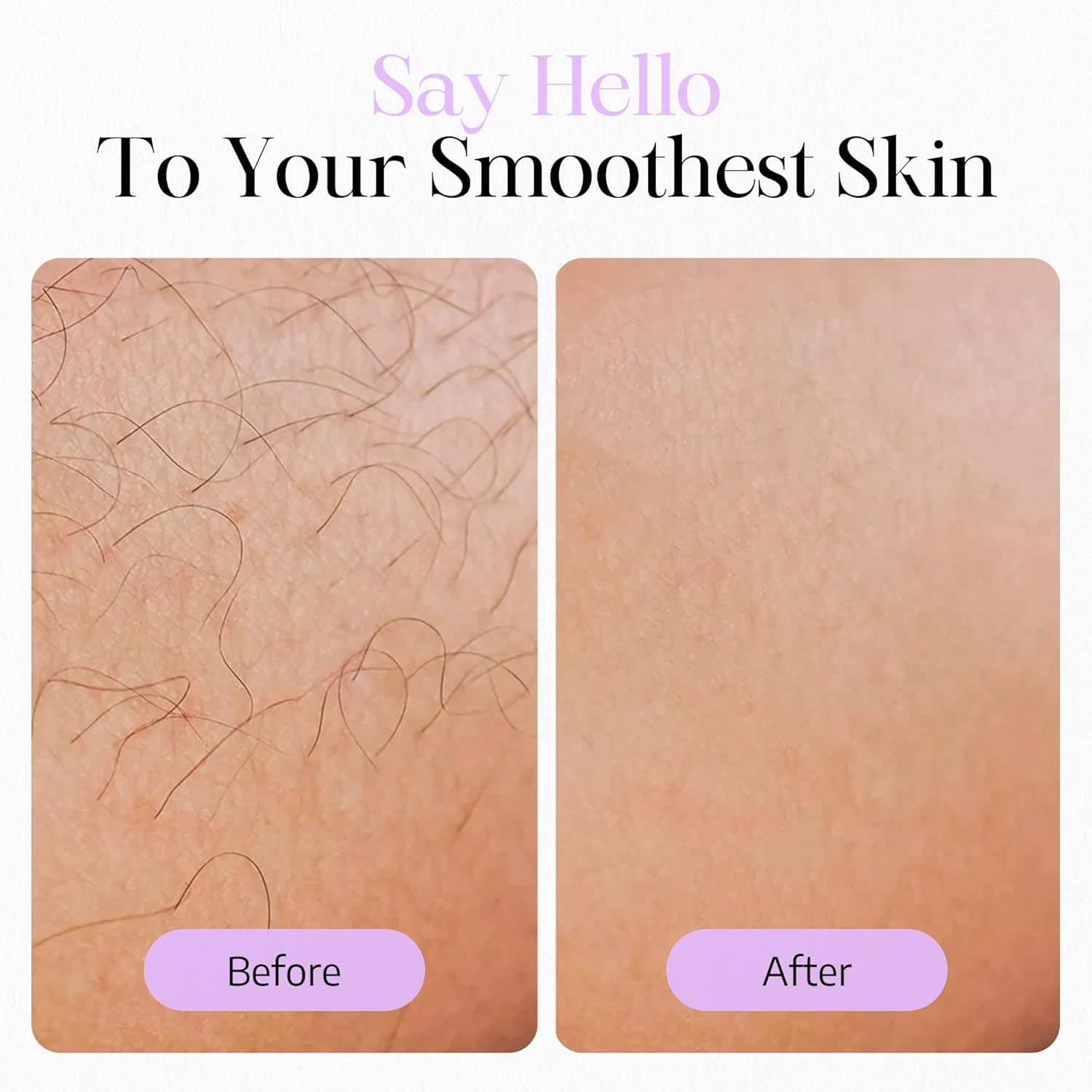 ILUUMI IPL Hair Removal Device for Face and Body, Permanent Hair Reduction for Women and Men, with 5 Intensity Levels and Ice-Cooling Technology, In-Home Use (Dark Green) - White image number 5