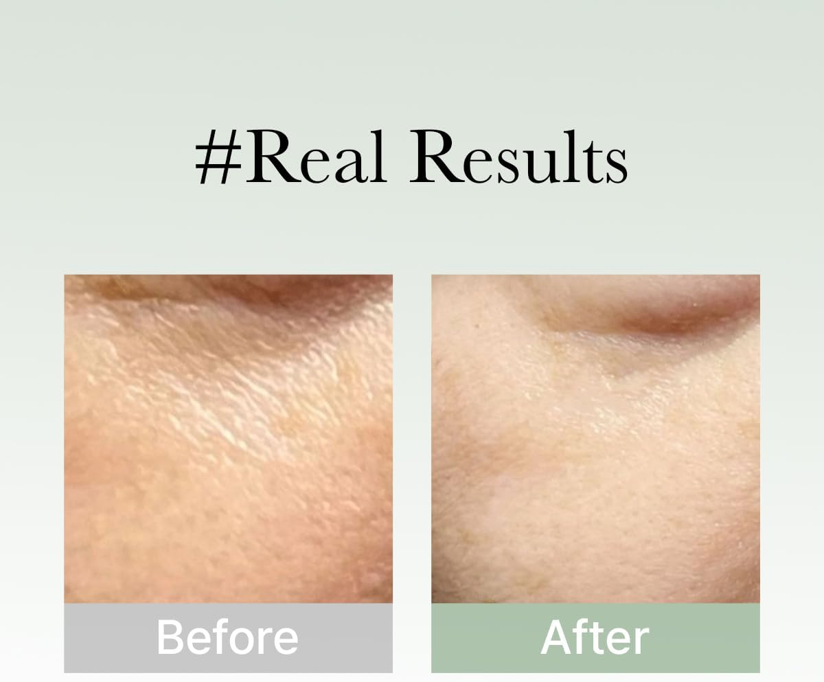 Medicube Arencia Holy Hyssop Serum 30 Ml