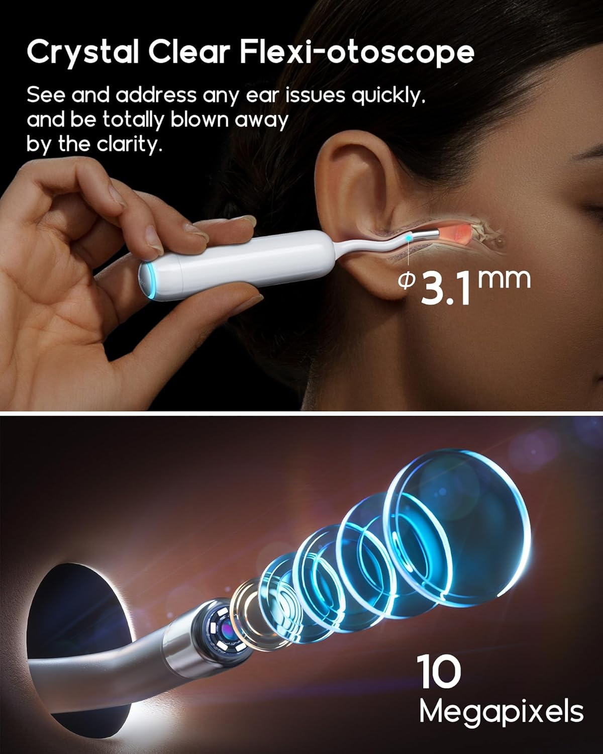 Bebird Home 30S Camera for Ear Canal Wax Removal Tool, Flexible Ear Viewing Scope Oto-Scope Cleaner with Cam, UVC Light, Visible Liquid Applicator & Tweezers, Video Earpick Kit for Adults & Kids image number 1