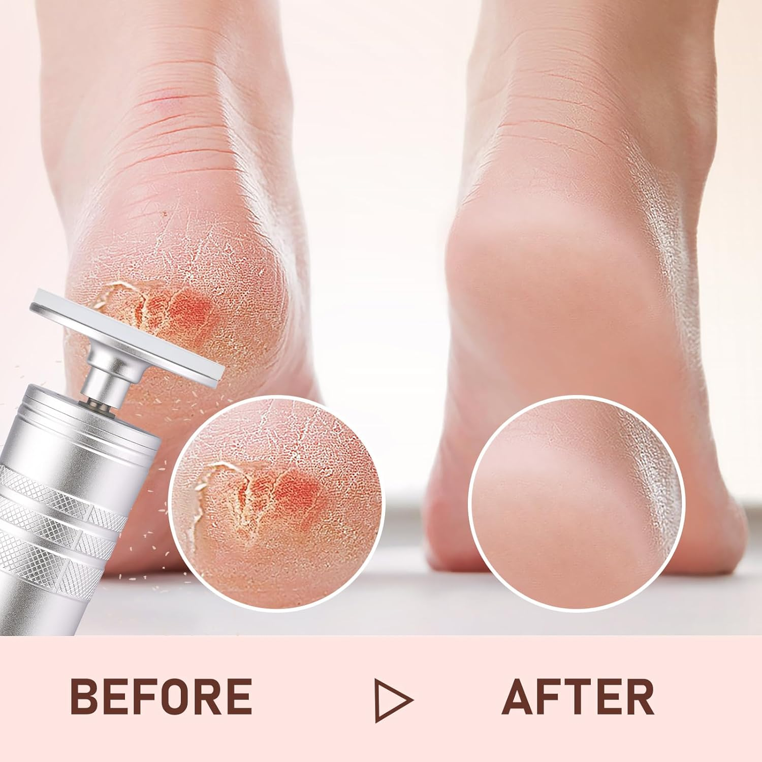 Kredioo Nail Drill Electric Foot File Callus Remover Scrubber for Women 5 Nano Glass File German Technology Grinding Sanding Pedicure Tools for Feet Sensitive Skin Adjust Speed R/F Direction Remove Calluses image number 6