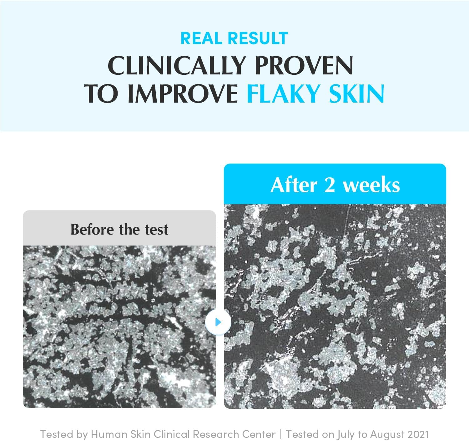 EQQUALBERRY Swimming Pool Daily Facial Toner, 155Ml, 8-Layer Hyaluronic Acid, Low Ph Formula, Enzyme Exfoliation, 5-Berry Complex, Sensitive Skin image number 2