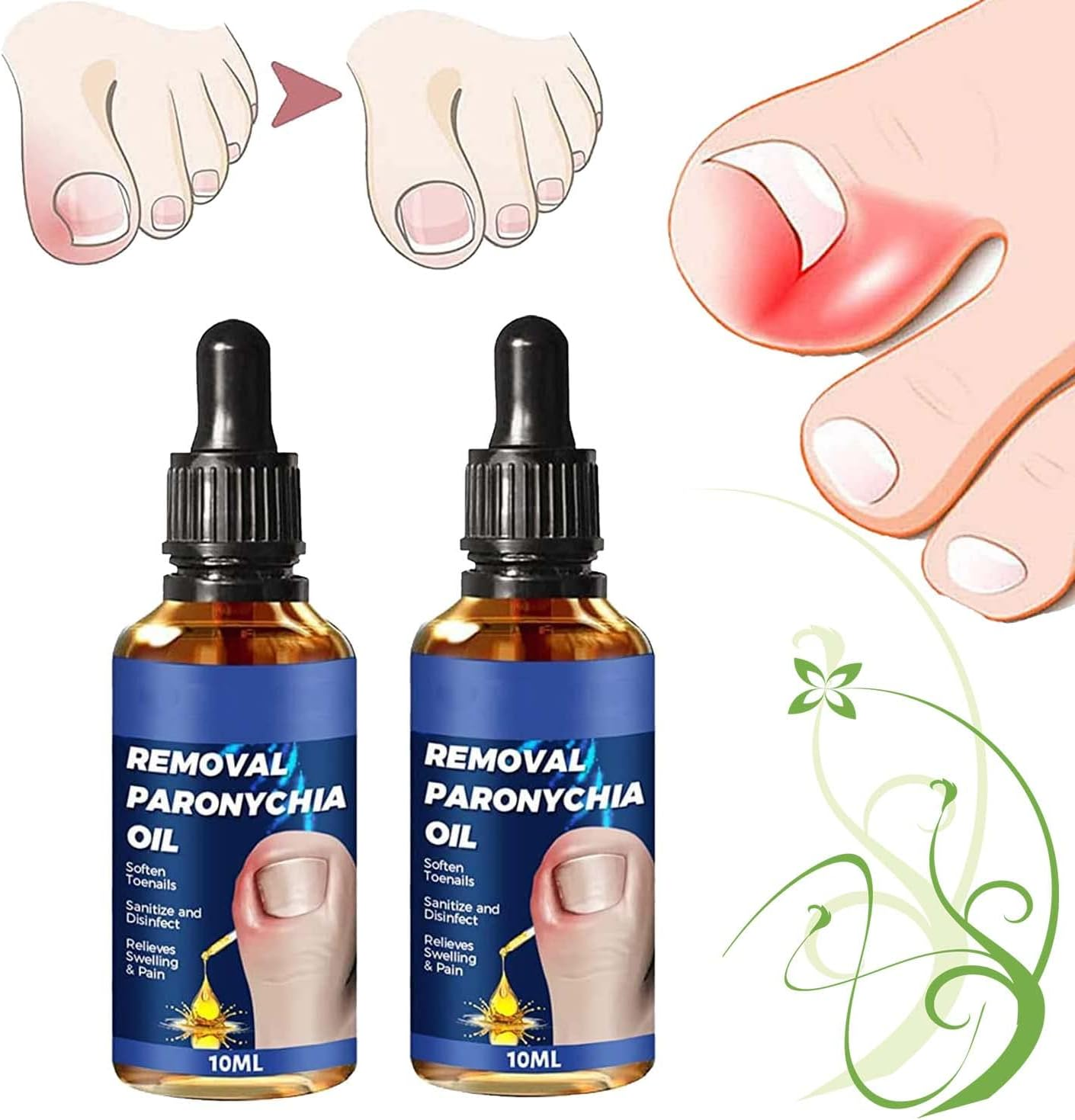 German Toenailcare Removal Paronychia Oil, German Toenailplus anti Paronychia Relief Oil, 2023 New German Toenail Care Removal Paronychia Oil (2PCS) image number 6