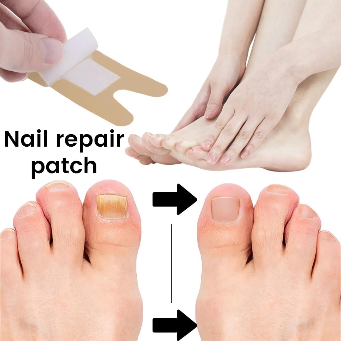 Pack of 25 Nail Patches Toenail Patches with Pedicure Tool Specially Shaped Multipurpose Toenail Pads for Care and Protection of Damaged and Brittle Nails image number 5